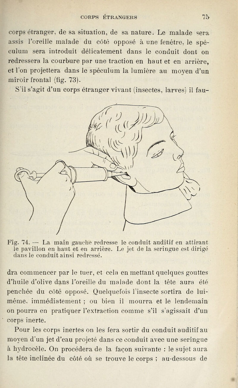corps étranger; de sa situation, de sa nature. Le malade sera assis l'oreille malade du côté opposé à une fenêtre, le spé- culum sera introduit délicatement dans le conduit dont on redressera la courbure par une traction en haut et en arrière, et l'on projettera dans le spéculum la lumière au moyen d'un miroir frontal (fig. 73). S'il s'agit d'un corps étranger vivant (insectes, larves) il fau- Fig. 74. — La main gauche redresse le conduit auditif en attirant le pavillon en haut et en arrière. Le jet de la seringue est dirigé dans le conduit ainsi redressé. dra commencer par le tuer, et cela en mettant quelques gouttes d'huile d'olive dans Loreille du malade dont la tête aura été penchée du côté opposé. Quelquefois l'insecte sortira de lui- même, immédiatement ; ou bien il mourra et le lendemain on pourra en pratiquer l'extraction comme s'il s'agissait d'un corps inerte. Pour les corps inertes on les fera sortir du conduit auditif au moyen d'un jet d'eau projeté dans ce conduit avec une seringue à hydrocèle. On procédera de la façon suivante : le sujet aura la tête inclinée du côté où se trouve le corps ; au-dessous de