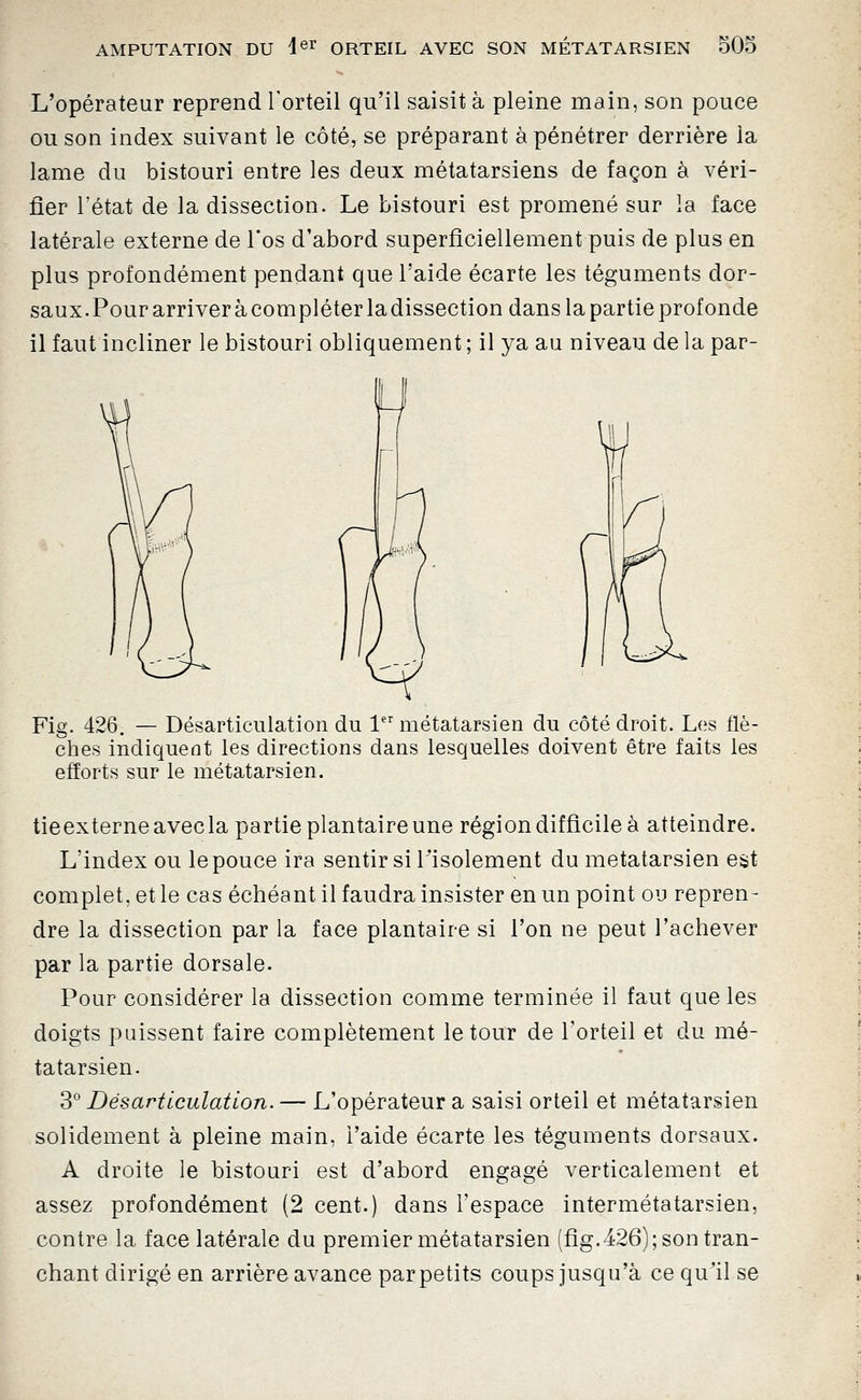 L'opérateur reprend l'orteil qu'il saisit à pleine main, son pouce ou son index suivant le côté, se préparant à pénétrer derrière la lame du bistouri entre les deux métatarsiens de façon à véri- fier l'état de la dissection. Le bistouri est promené sur la face latérale externe de l'os d'abord superficiellement puis de plus en plus profondément pendant que l'aide écarte les téguments dor- saux. Pour arriver à compléter la dissection dans la partie profonde il faut incliner le bistouri obliquement ; il ya au niveau de la par- Fig. 426. — Désarticulation du 1 métatarsien du côté droit. Los flè- ches indiquent les directions dans lesquelles doivent être faits les efforts sur le métatarsien. tieexterne avec la partie plantaire une région difficile à atteindre. L'index ou le pouce ira sentir si l'isolement du métatarsien est complet, et le cas échéant il faudra insister en un point ou repren- dre la dissection par la face plantaire si l'on ne peut l'achever par la partie dorsale. Pour considérer la dissection comme terminée il faut que les doigts puissent faire complètement le tour de l'orteil et du mé- tatarsien. '^'^ Désarticulation.— L'opérateur a saisi orteil et métatarsien solidement à pleine main, l'aide écarte les téguments dorsaux. A droite le bistouri est d'abord engagé verticalement et assez profondément (2 cent.) dans l'espace intermétatarsien, contre la face latérale du premier métatarsien (fig.426); son tran- chant dirigé en arrière avance par petits coups jusqu'à ce qu^il se