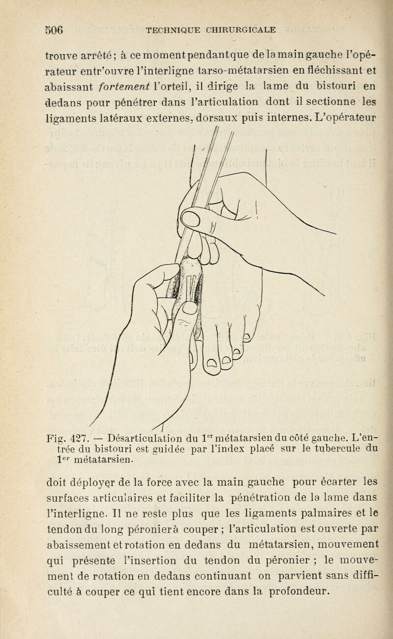 trouve arrêté; à ce moment pendantque de la main gauche l'opé- rateur entr'ouvre l'interligne tarso-métatarsien en fléchissant et abaissant fortement l'orteil, il dirige la lame du bistouri en dedans pour pénétrer dans l'articulation dont il sectionne les ligaments latéraux externes, dorsaux puis internes. L'opérateur Fig. 427. — Désarticulation du 1 métatarsien du côté gauche. L'en- trée du bistouri est guidée par l'index placé sur le tubercule du 1^*' métatarsien. doit déployer de la force avec la main gauche pour écarter les surfaces articulaires et faciliter la pénétration de la lame dans l'interligne. Il ne reste plus que les ligaments palmaires et le tendon du long péronierà couper ; l'articulation est ouverte par abaissement et rotation en dedans du métatarsien, mouvement qui présente l'insertion du tendon du péronier ; le mouve- ment de rotation en dedans continuant on parvient sans diffi- culté à couper ce qui tient encore dans la profondeur.