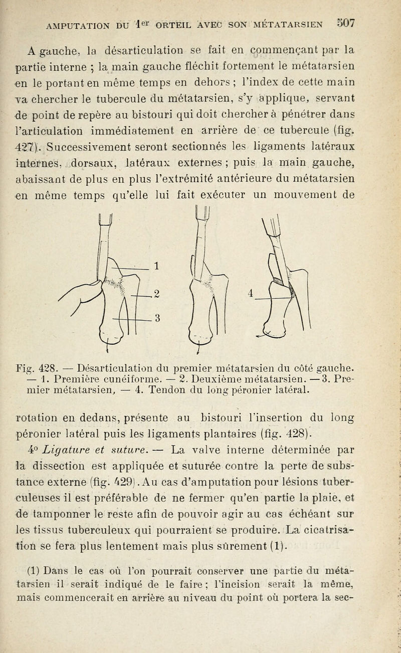 A gauche, la désarticulation se fait en commençant par la partie interne ; la main gauche fléchit fortement le métatarsien en le portant en même temps en dehors ; l'index de cette main va chercher le tubercule du métatarsien, s'y applique, servant de point de repère au bistouri qui doit chercher à pénétrer dans l'articulation immédiatement en arrière de ce tubercule (fig. 427).. Successivement seront sectionnés les ligaments latéraux internes, dorsaux, latéraux externes ; puis la main gauche, abaissant de plus en plus l'extrémité antérieure du métatarsien =en même temps qu'elle lui fait exécuter un mouvement de Fig. 428. — Désarticulation du premier métatarsien du côté gauche. — 1. Première cunéiforme. — 2. Deuxième métatarsien. —3. Pre- mier métatarsien, — 4. Tendon du long péronier latéral. Totation en dedans, présente au bistouri l'insertion du long péronier latéral puis les ligaments plantaires (fîg. 428). 4^ Ligature et suture. — La valve interne déterminée par la dissection est appliquée et suturée contre la perte de subs- tance externe (fig. 429). Au cas d'amputation pour lésions tuber- culeuses il est préférable de ne fermer qu'en partie la plaie, et de tamponner le reste afin de pouvoir agir au cas échéant sur les tissus tuberculeux qui pourraient se produire. La cicatrisa- tion se fera plus lentement mais plus sûrement (1). (1) Dans le cas où l'on pourrait conserver une partie du méta- tarsien il serait indiqué de le faire ; l'incision serait la même, mais commencerait en arrière au niveau du point où portera la sec-