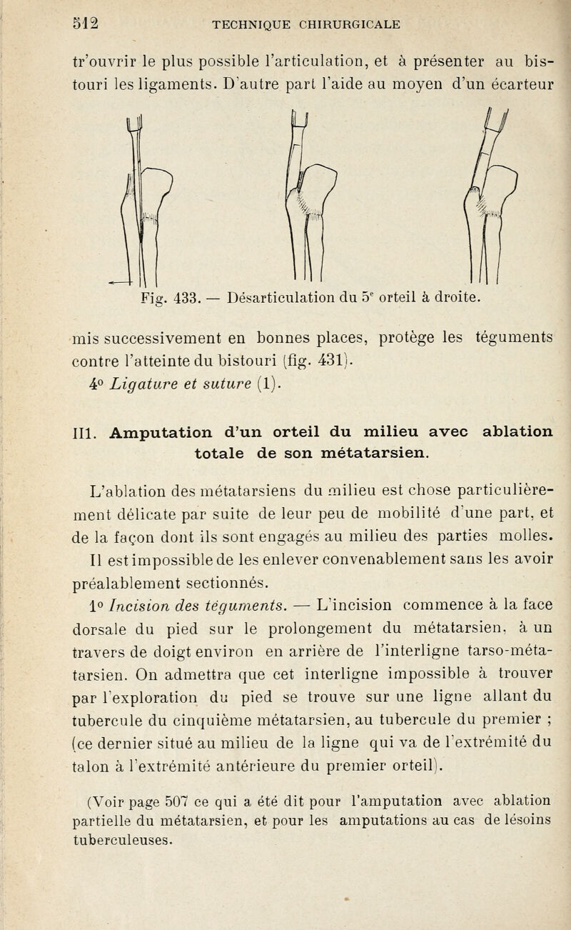 tr'ouvrir le plus possible l'articulation, et à présenter au bis- touri les ligaments. D'autre part l'aide au moyen d'un écarteur Fie. 433. — Désarticulation du 5' orteil à droite. mis successivement en bonnes places, protège les téguments contre l'atteinte du bistouri (fig. 431). 4^ Ligature et suture (1). III. Amputation d'un orteil du milieu avec ablation totale de son métatarsien. L'ablation des métatarsiens du milieu est chose particulière- ment délicate par suite de leur peu de mobilité d une part, et de la façon dont ils sont engagés au milieu des parties molles. Il est impossible de les enlever convenablement sans les avoir préalablement sectionnés. 1» Incision des téguments. — L'incision commence à la face dorsale du pied sur le prolongement du métatarsien, à un travers de doigt environ en arrière de l'interligne tarso-méta- tarsien. On admettra que cet interligne impossible à trouver par Texploration du pied se trouve sur une ligne allant du tubercule du cinquième métatarsien, au tubercule du premier ; (ce dernier situé au milieu de la ligne qui va de Textrémité du talon à l'extrémité antérieure du premier orteil). (Voir page 507 ce qui a été dit pour l'amputation avec ablation partielle du métatarsien, et pour les amputations au cas de lésoins tuberculeuses.