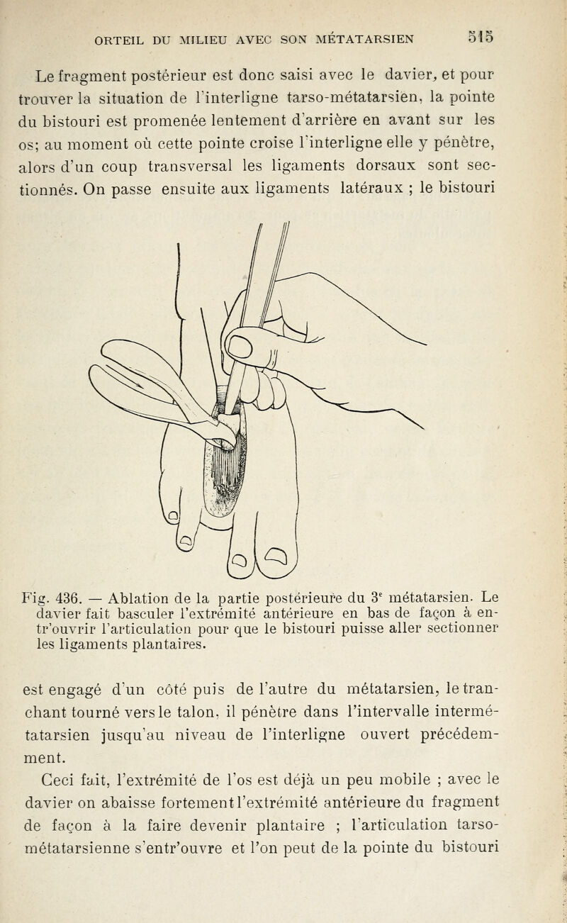 Le fragment postérieur est donc saisi avec le davier^ et pour trouver la situation de l'interligne tarso-métatarsien, la pointe du bistouri est promenée lentement d'arrière en avant sur les os; au moment où cette pointe croise Tinterligne elle y pénètre, alors d'un coup transversal les ligaments dorsaux sont sec- tionnés. On passe ensuite aux ligaments latéraux ; le bistouri Fig. 436. — Ablation de la partie postérieure du 3' métatarsien. Le davier fait basculer l'extrémité antérieure en bas de façon à en- tr ouvrir rarticulation pour que le bistouri puisse aller sectionner les ligaments plantaires. est engagé d'un côté puis de l'autre du métatarsien, le tran- chant tourné vers le talon, il pénètre dans l'intervalle intermé- tatarsien jusqu'au niveau de l'interligne ouvert précédem- ment. Ceci fait, l'extrémité de l'os est déjà un peu mobile ; avec le davier on abaisse fortement l'extrémité antérieure du fragment de façon à la faire devenir plantaire ; l'articulation tarso- métatarsienne s'entr'ouvre et l'on peut de la pointe du bistouri