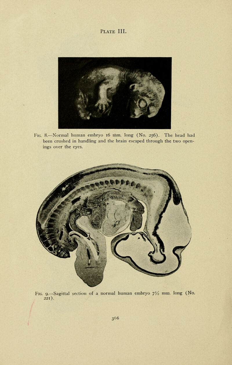 Fig. 8.—Normal human embryo 16 mm. long (No. 256). The head had been crushed in handling and the brain escaped through the two open- ings over the eyes. Fig. 9.—Sagittal section of a normal human embryo 7^2 mm. long (No. 221).