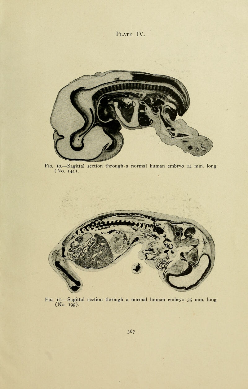 Fig. io.—Sagittal section through-a normal human embryo 14 mm. long (No. 144). Fig. 11.—Sagittal section through a normal human embryo 35 mm. long (No. 199). 367