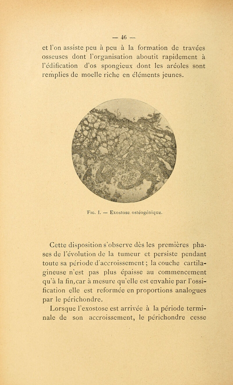 et l'on assiste peu à peu à la formation de travées osseuses dont l'organisation aboutit rapidement à l'édification d'os spongieux dont les aréoles sont remplies de moelle riche en éléments jeunes. •4- ^ ,--«!»ry \ FiG. I. — Exostose, ostéogénique. Cette disposition s'observe dès les premières pha- ses de révolution de la tumeur et persiste pendant toute sa période d'accroissement ; la couche cartila- gineuse n'est pas plus épaisse au commencement qu'à la fin^car à mesure qu'elle est envahie par l'ossi- fication elle est reformée en proportions analogues par le périchondre. Lorsque l'exostose est arrivée à la période termi- nale de son accroissement, le périchondre cesse