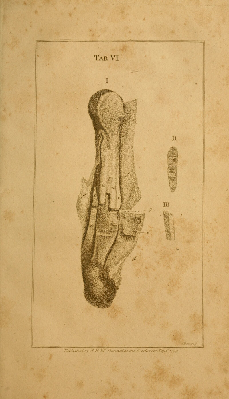 DoriaUas &LeAcicU,'e6& StpiJ' l?