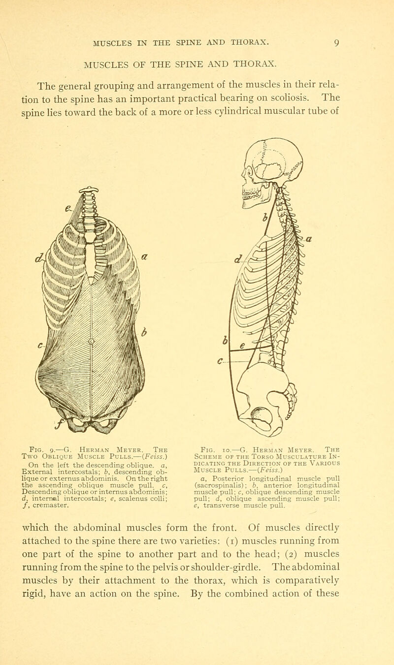 MUSCLES OF THE SPINE AND THORAX. The general grouping and arrangement of the muscles in their rela- tion to the spine has an important practical bearing on scoliosis. The spine lies toward the back of a more or less cylindrical muscular tube of Fig. 9.—G. Herman Meyer. The Two Oblique Muscle Pulls.—(Feiss.) On the left the descending oblique, a, External intercostals; b, descending ob- lique or externus abdominis. On the right the ascending oblique muscle pull, c. Descending oblique or internus abdominis; d, internal intercostals; e, scalenus colli; /, cremaster. Fig. 10.—G. Herman Meyer. The Scheme of the Torso Musculature In- dicating the Direction of the Various Muscle Pulls.—{Feiss.) a, Posterior longitudinal muscle pull (sacrospinalis); b, anterior longitudinal muscle pull; c, oblique descending muscle pull; d, oblique ascending muscle pull; e, transverse muscle pull. which the abdominal muscles form the front. Of muscles directly attached to the spine there are two varieties: (i) muscles running from one part of the spine to another part and to the head; (2) muscles running from the spine to the pelvis or shoulder-girdle. The abdominal muscles by their attachment to the thorax, which is comparatively rigid, have an action on the spine. By the combined action of these