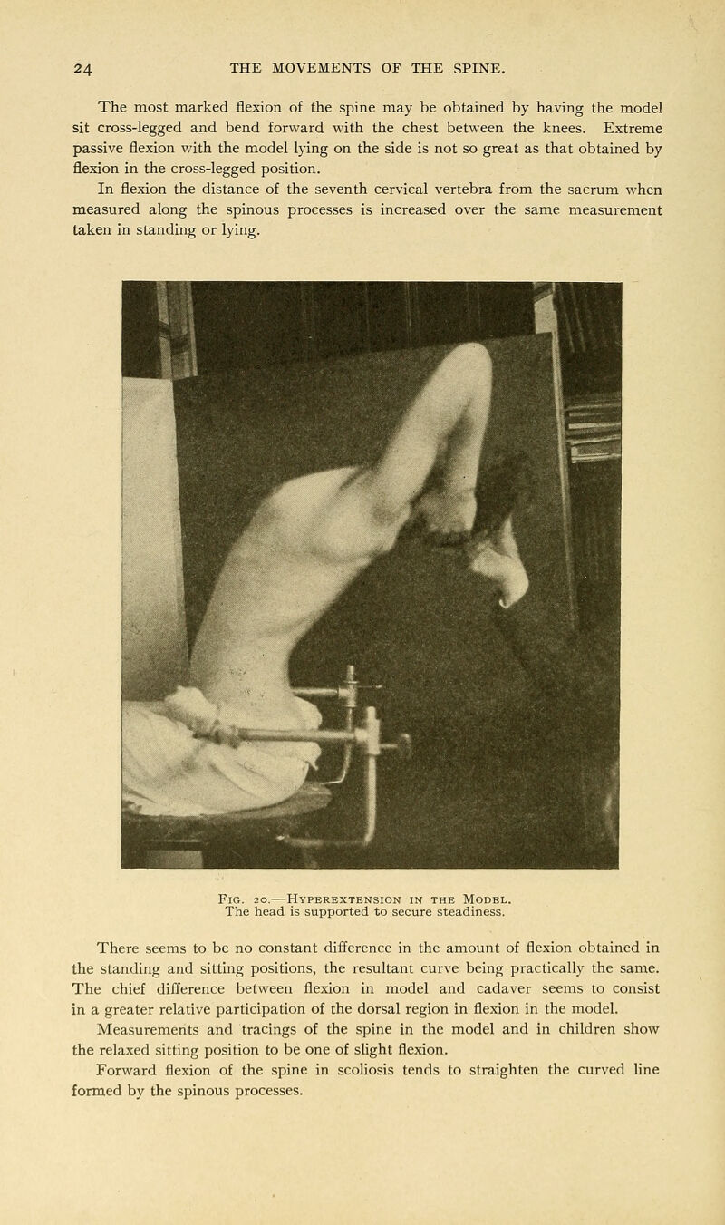 The most marked flexion of the spine may be obtained by having the model sit cross-legged and bend forward with the chest between the knees. Extreme passive flexion with the model lying on the side is not so great as that obtained by flexion in the cross-legged position. In flexion the distance of the seventh cervical vertebra from the sacrum when measured along the spinous processes is increased over the same measurement taken in standing or lying. Fig. 20.—Hyperextension in the Model. The head is supported to secure steadiness. There seems to be no constant difference in the amount of flexion obtained in the standing and sitting positions, the resultant curve being practically the same. The chief difference between flexion in model and cadaver seems to consist in a greater relative participation of the dorsal region in flexion in the model. Measurements and tracings of the spine in the model and in children show the relaxed sitting position to be one of slight flexion. Forward flexion of the spine in scoliosis tends to straighten the curved line formed by the spinous processes.