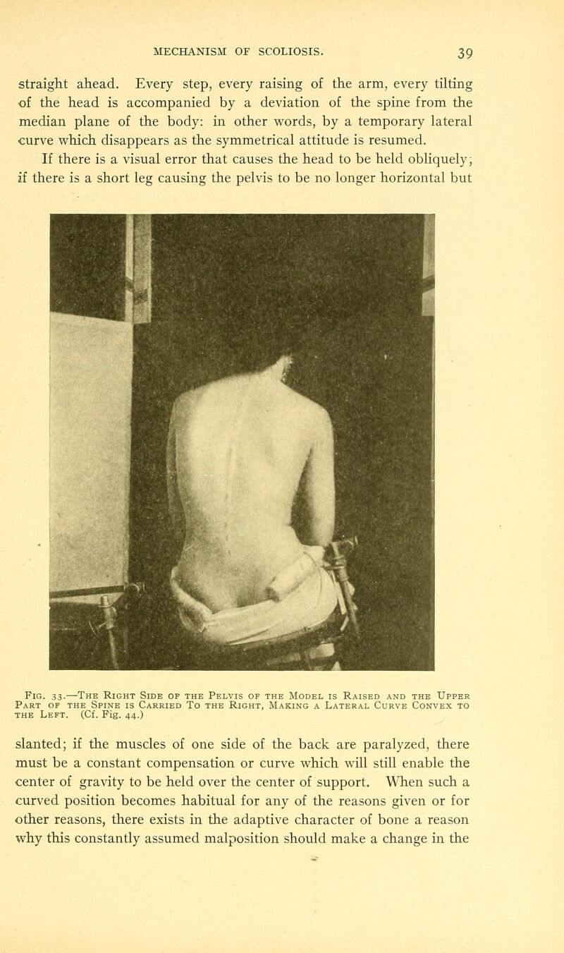 straight ahead. Every step, every raising of the arm, every tilting of the head is accompanied by a deviation of the spine from the median plane of the body: in other words, by a temporary lateral curve which disappears as the symmetrical attitude is resumed. If there is a visual error that causes the head to be held obliquely; if there is a short leg causing the pelvis to be no longer horizontal but Fig. 33.—The Right Side of the Pelvis of the Model is Raised and the Upper Part of the Spine is Carried To the Right, Making a Lateral Curve Convex to the Left. (Cf. Fig. 44.) slanted; if the muscles of one side of the back are paralyzed, there must be a constant compensation or curve which will still enable the center of gravity to be held over the center of support. When such a curved position becomes habitual for any of the reasons given or for other reasons, there exists in the adaptive character of bone a reason why this constantly assumed malposition should make a change in the