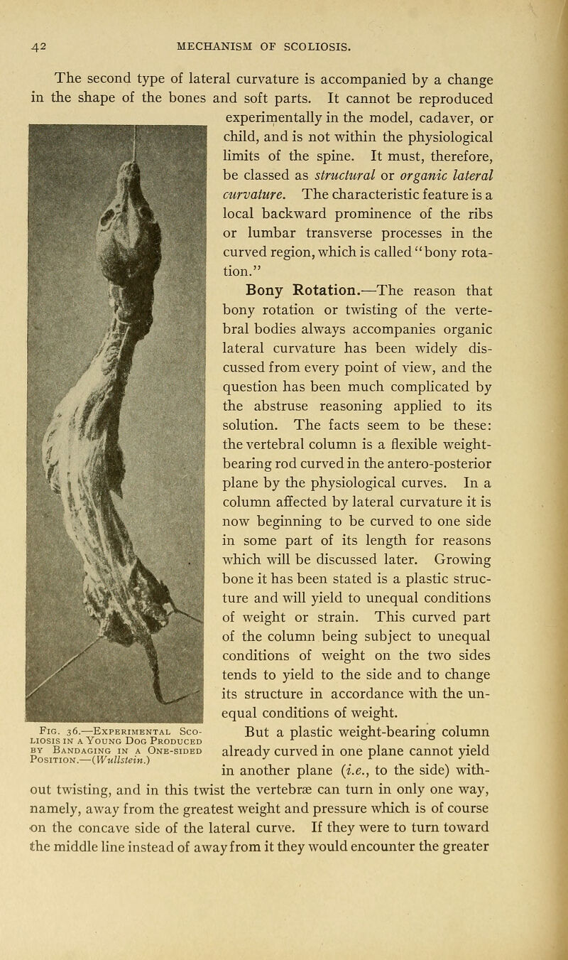 The second type of lateral curvature is accompanied by a change in the shape of the bones and soft parts. It cannot be reproduced experimentally in the model, cadaver, or child, and is not within the physiological limits of the spine. It must, therefore, be classed as structural or organic lateral curvature. The characteristic feature is a local backward prominence of the ribs or lumbar transverse processes in the curved region, which is called bony rota- tion. Bony Rotation.—The reason that bony rotation or twisting of the verte- bral bodies always accompanies organic lateral curvature has been widely dis- cussed from every point of view, and the question has been much complicated by the abstruse reasoning applied to its solution. The facts seem to be these: the vertebral column is a flexible weight- bearing rod curved in the antero-posterior plane by the physiological curves. In a column affected by lateral curvature it is now beginning to be curved to one side in some part of its length for reasons which will be discussed later. Growing bone it has been stated is a plastic struc- ture and will yield to unequal conditions of weight or strain. This curved part of the column being subject to unequal conditions of weight on the two sides tends to yield to the side and to change its structure in accordance with the un- equal conditions of weight. But a plastic weight-bearing column already curved in one plane cannot yield in another plane {i.e., to the side) with- out twisting, and in this twist the vertebrae can turn in only one way, namely, away from the greatest weight and pressure which is of course on the concave side of the lateral curve. If they were to turn toward the middle line instead of away from it they would encounter the greater Fig. 36.—Experimental Sco- liosis in a Young Dog Produced by Bandaging in a One-sided Position.—(Wullstein.)