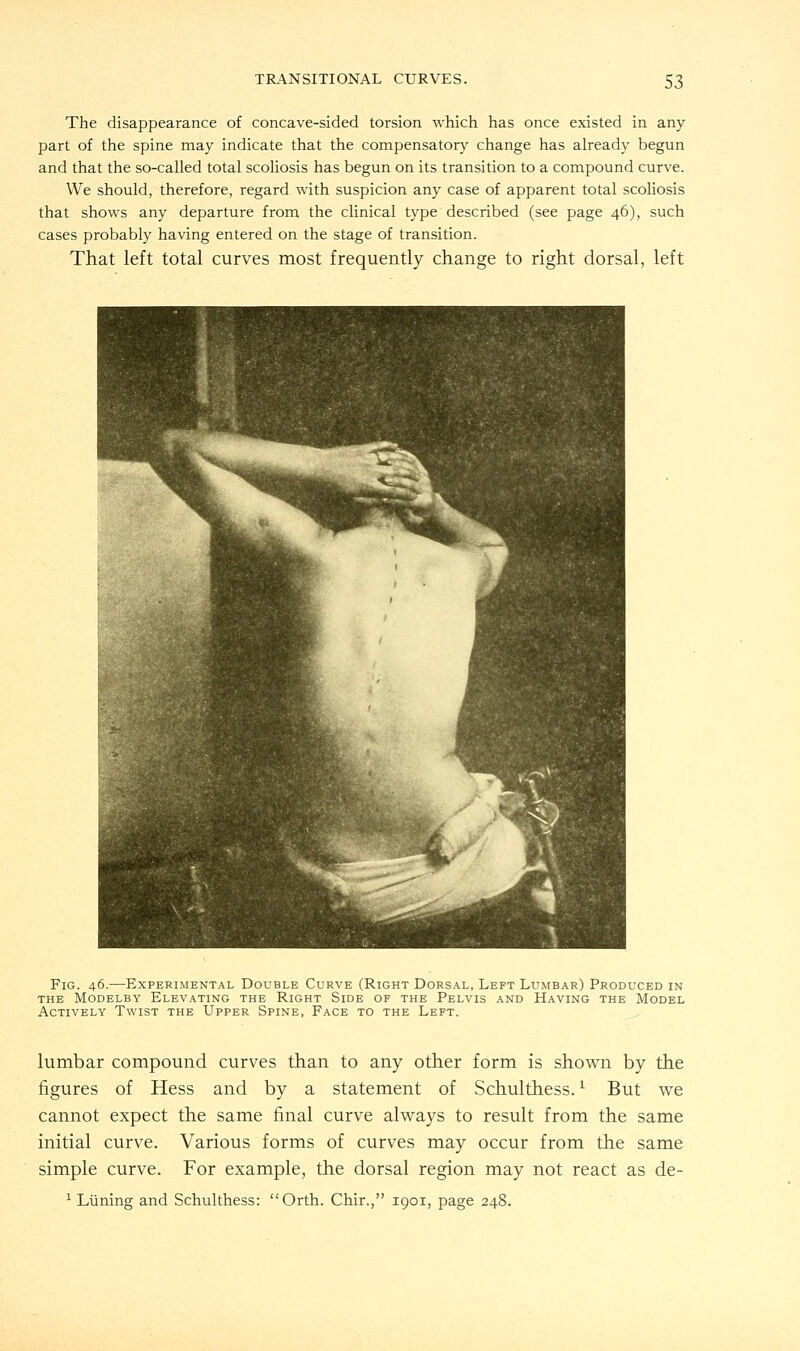 The disappearance of concave-sided torsion which has once existed in any part of the spine may indicate that the compensatory change has already begun and that the so-called total scoliosis has begun on its transition to a compound curve. We should, therefore, regard with suspicion any case of apparent total scoliosis that shows any departure from the clinical type described (see page 46), such cases probably having entered on the stage of transition. That left total curves most frequently change to right dorsal, left Fig. 46.—Experimental Double Curve (Right Dorsal, Left Lumbar) Produced in the Modelby Elevating the Right Side of the Pelvis and Having the Model Actively Twist the Upper Spine, Face to the Left. lumbar compound curves than to any other form is shown by the figures of Hess and by a statement of Schulthess.l But we cannot expect the same final curve always to result from the same initial curve. Various forms of curves may occur from the same simple curve. For example, the dorsal region may not react as de- 1 Luning and Schulthess: Orth. Chir., 1901, page 248.