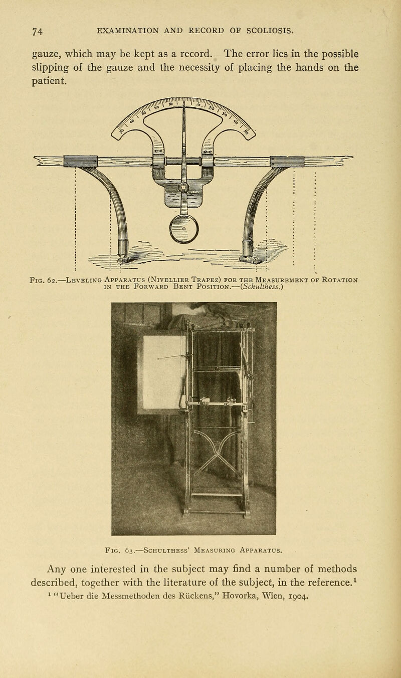 gauze, which may be kept as a record. The error lies in the possible slipping of the gauze and the necessity of placing the hands on the patient. Fig. 62.—Leveling Apparatus (Nivellier Trapez) for the Measurement op Rotation in the Forward Bent Position.—(Schulihess.) Fig. 63.—Schulthess' Measuring Apparatus. Any one interested in the subject may find a number of methods described, together with the literature of the subject, in the reference.1 1 Ueber die Messmethoden des Ruckens, Hovorka, Wien, 1904.