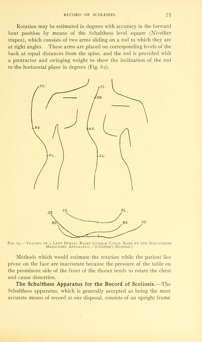 Rotation may be estimated in degrees with accuracy in the forward bent position by means of the Schulthess level square (Nivellier trapez), which consists of two arms sliding on a rod to which they are at right angles. These arms are placed on corresponding levels of the back at equal distances from the spine, and the rod is provided with a protractor and swinging weight to show the inclination of the rod to the horizontal plane in degrees (Fig. 62). Fig. 64.—Tracing of a Left Dorsal Right Lumbar Curve Made by the Schulthess Measuring Apparatus.—(Children's Hospital.) Methods which would estimate the rotation while the patient lies prone on the face are inaccurate because the pressure of the table on the prominent side of the front of the thorax tends to rotate the chest and cause distortion. The Schulthess Apparatus for the Record of Scoliosis.—The Schulthess apparatus, which is generally accepted as being the most accurate means of record at our disposal, consists of an upright frame