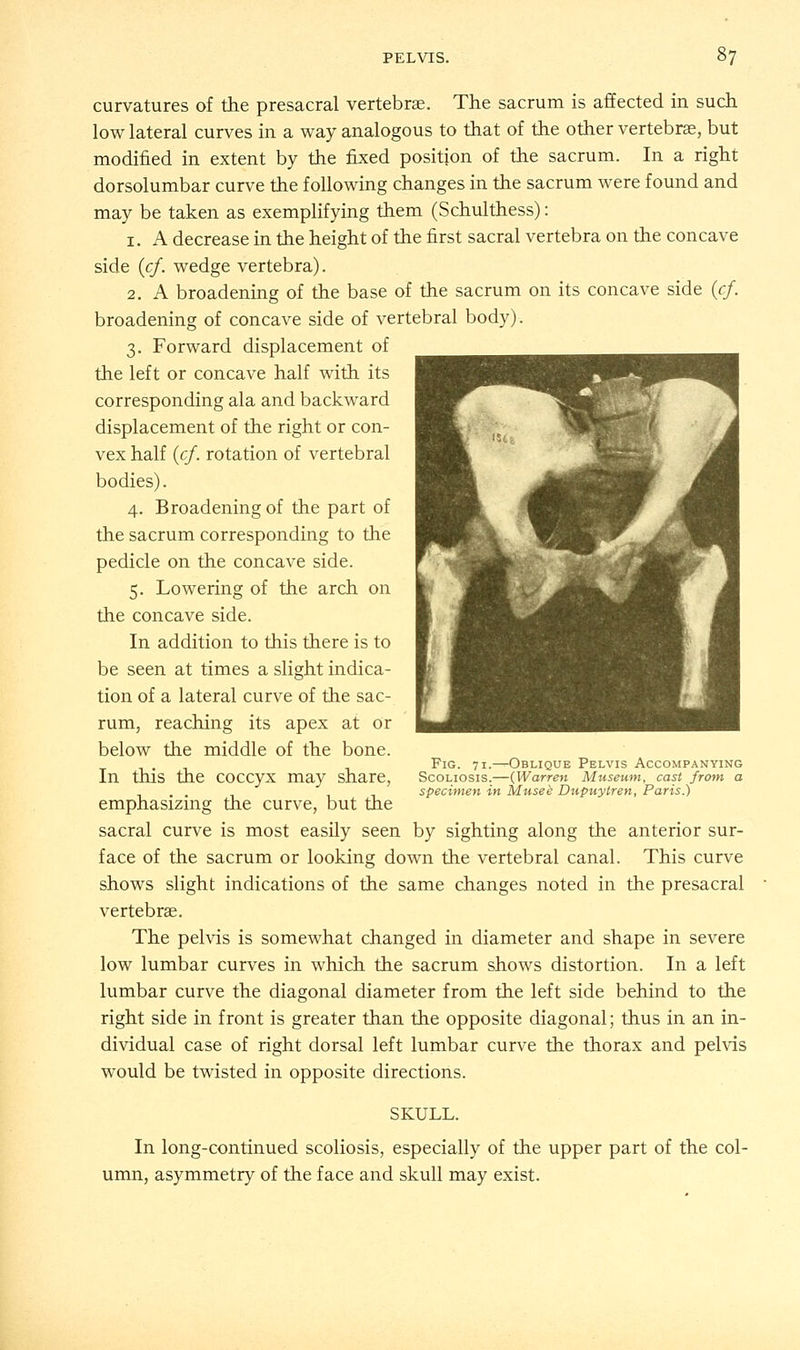curvatures of the presacral vertebrae. The sacrum is affected in such low lateral curves in a way analogous to that of the other vertebras, but modified in extent by the fixed position of the sacrum. In a right dorsolumbar curve the following changes in the sacrum were found and may be taken as exemplifying them (Schulthess): 1. A decrease in the height of the first sacral vertebra on the concave side (cf. wedge vertebra). 2. A broadening of the base of the sacrum on its concave side (cf. broadening of concave side of vertebral body). 3. Forward displacement of the left or concave half with its corresponding ala and backward displacement of the right or con- vex half (cf. rotation of vertebral bodies). 4. Broadening of the part of the sacrum corresponding to the pedicle on the concave side. 5. Lowering of the arch on the concave side. In addition to this there is to be seen at times a slight indica- tion of a lateral curve of the sac- rum, reaching its apex at or below the middle of the bone. In this the coccyx may share, emphasizing the curve, but the sacral curve is most easily seen by sighting along the anterior sur- face of the sacrum or looking down the vertebral canal. This curve shows slight indications of the same changes noted in the presacral vertebras. The pelvis is somewhat changed in diameter and shape in severe low lumbar curves in which the sacrum shows distortion. In a left lumbar curve the diagonal diameter from the left side behind to the right side in front is greater than the opposite diagonal; thus in an in- dividual case of right dorsal left lumbar curve the thorax and pelvis would be twisted in opposite directions. SKULL. In long-continued scoliosis, especially of the upper part of the col- umn, asymmetry of the face and skull may exist. Fig. 71.—Oblique Pelvis Accompanying Scoliosis.—(Warren Museum, cast from a specimen in Musee Dupuytren, Paris.)