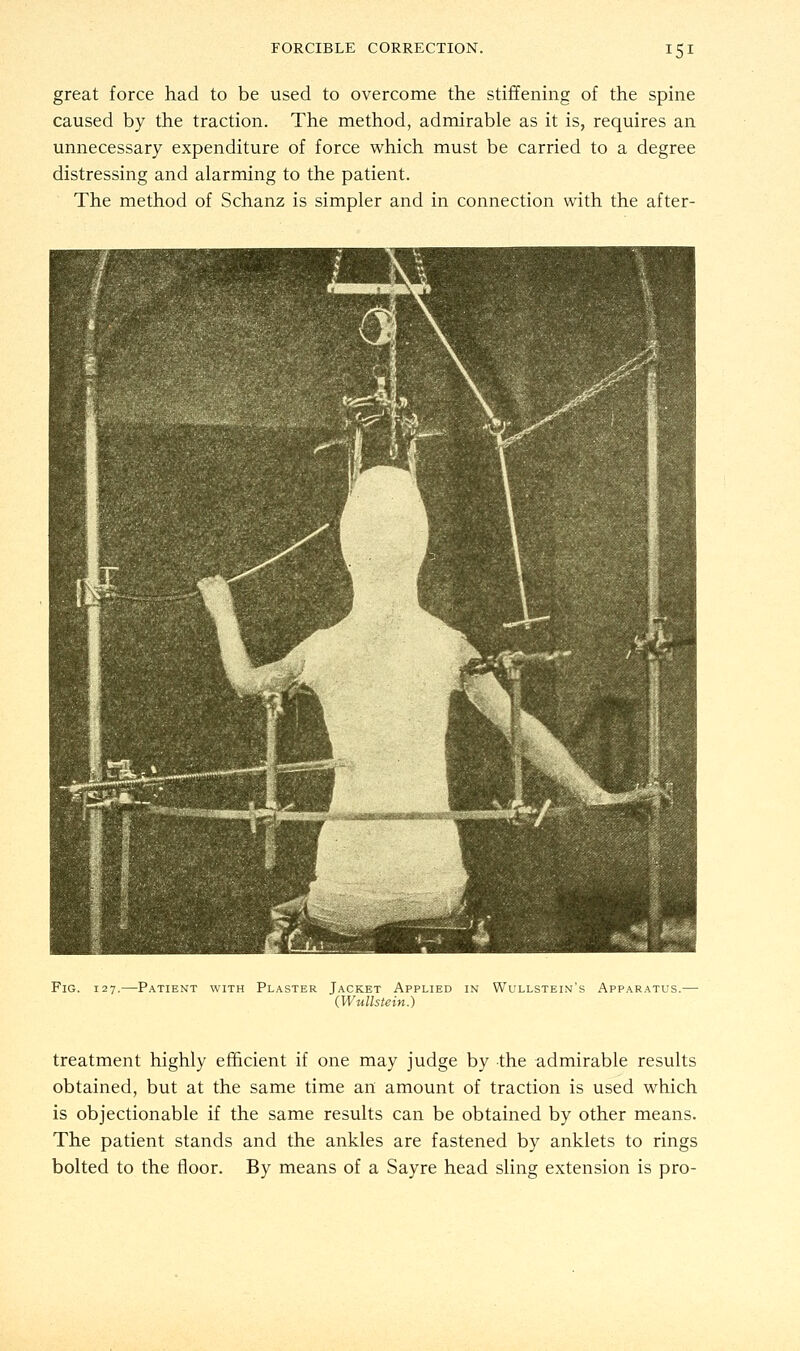 great force had to be used to overcome the stiffening of the spine caused by the traction. The method, admirable as it is, requires an unnecessary expenditure of force which must be carried to a degree distressing and alarming to the patient. The method of Schanz is simpler and in connection with the after- Fig. 127.—-Patient with Plaster Jacket Applied in Wullstein's Apparatus.- (Wullstein.) treatment highly efficient if one may judge by the admirable results obtained, but at the same time an amount of traction is used which is objectionable if the same results can be obtained by other means. The patient stands and the ankles are fastened by anklets to rings bolted to the floor. By means of a Sayre head sling extension is pro-