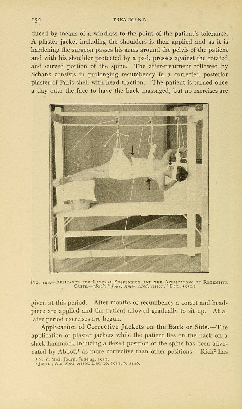 duced by means of a windlass to the point of the patient's tolerance. A plaster jacket including the shoulders is then applied and as it is hardening the surgeon passes his arms around the pelvis of the patient and with his shoulder protected by a pad, presses against the rotated and curved portion of the spine. The after-treatment followed by Schanz consists in prolonging recumbency in a corrected posterior plaster-of-Paris shell with head traction. The patient is turned once a day onto the face to have the back massaged, but no exercises are Pig. 128. -Appliance for Lateral Suspension and the Application of Retentive Casts.—(Rich, Jour. Amer. Med. Assoc, Dec, 1911.) given at this period. After months of recumbency a corset and head- piece are applied and the patient allowed gradually to sit up. At a later period exercises are begun. Application of Corrective Jackets on the Back or Side.—The application of plaster jackets while the patient lies on the back on a slack hammock inducing a flexed position of the spine has been advo- cated by Abbott1 as more corrective than other positions. Rich2 has 1N. Y. Med. Journ. June 24, 1911. 2 Journ., Am. Med. Assoc. Dec. 30, 1911, p. 2120.