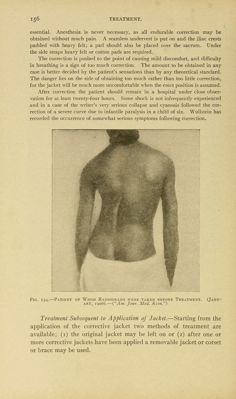 essential. Anesthesia is never necessary, as all endurable correction may be obtained without much pain. A seamless undervest is put on and the iliac crests padded with heavy felt; a pad should also be placed over the sacrum. Under the side straps heavy felt or cotton pads are required. The correction is pushed to the point of causing mild discomfort, and difficulty in breathing is a sign of too much correction. The amount to be obtained in any case is better decided by the patient's sensations than by any theoretical standard. The danger lies on the side of obtaining too much rather than too little correction, for the jacket will be much more uncomfortable when the erect position is assumed. After correction the patient should remain in a hospital under close obser- vation for at least twenty-four hours. Some shock is not infrequently experienced and in a case of the writer's very serious collapse and cyanosis followed the cor- rection of a severe curve due to infantile paralysis in a child of six. Wullstein has recorded the occurrence of somewhat serious symptoms following correction. Fig. 134. -Patient of Whom Radiograms were taken before Treatment. ary, 1906).—(Am. Jour. Med. Assn.) (Janu- Treatment Subsequent to Application of Jacket.—Starting from the application of the corrective jacket two methods of treatment are available; (1) the original jacket may be left on or (2) after one or more corrective jackets have been applied a removable jacket or corset or brace may be used.