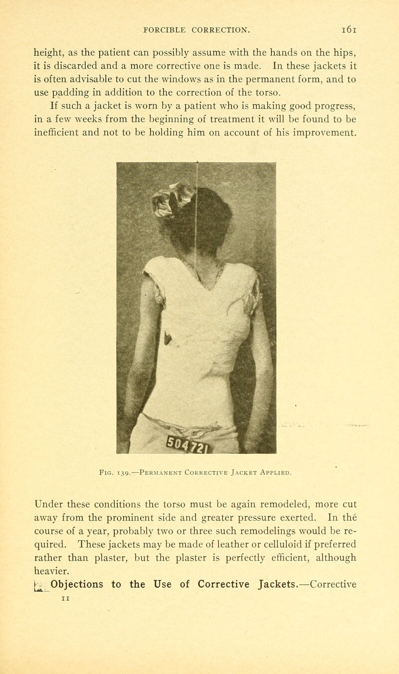 height, as the patient can possibly assume with the hands on the hips, it is discarded and a more corrective one is made. In these jackets it is often advisable to cut the windows as in the permanent form, and to use padding in addition to the correction of the torso. If such a jacket is worn by a patient who is making good progress, in a few weeks from the beginning of treatment it will be found to be inefficient and not to be holding him on account of his improvement. Fig. 139.—-Permanent Corrective Jacket Applied. Under these conditions the torso must be again remodeled, more cut away from the prominent side and greater pressure exerted. In the course of a year, probably two or three such remodelings would be re- quired. These jackets may be made of leather or celluloid if preferred rather than plaster, but the plaster is perfectly efficient, although heavier. |*H Objections to the Use of Corrective Jackets.—Corrective