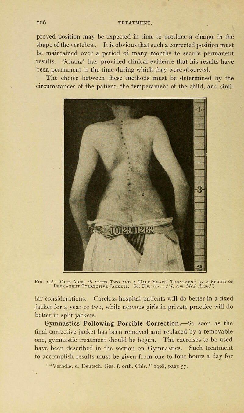 proved position may be expected in time to produce a change in the shape of the vertebras. It is obvious that such a corrected position must be maintained over a period of many months to secure permanent results. Schanz1 has provided clinical evidence that his results have been permanent in the time during which they were observed. The choice between these methods must be determined by the circumstances of the patient, the temperament of the child, and simi- Fig. 146.—Girl Aged 18 after Two and a Half Years' Treatment by a Series of Permanent Corrective Jackets. See Fig. 145.—(/. Am. Med. Assn.) lar considerations. Careless hospital patients will do better in a fixed jacket for a year or two, while nervous girls in private practice will do better in split jackets. Gymnastics Following Forcible Correction.—So soon as the final corrective jacket has been removed and replaced by a removable one, gymnastic treatment should be begun. The exercises to be used have been described in the section on Gymnastics. Such treatment to accomplish results must be given from one to four hours a day for 1 Verhdlg. d. Deutsch. Ges. f. orth. Chir., 1908, page 57.