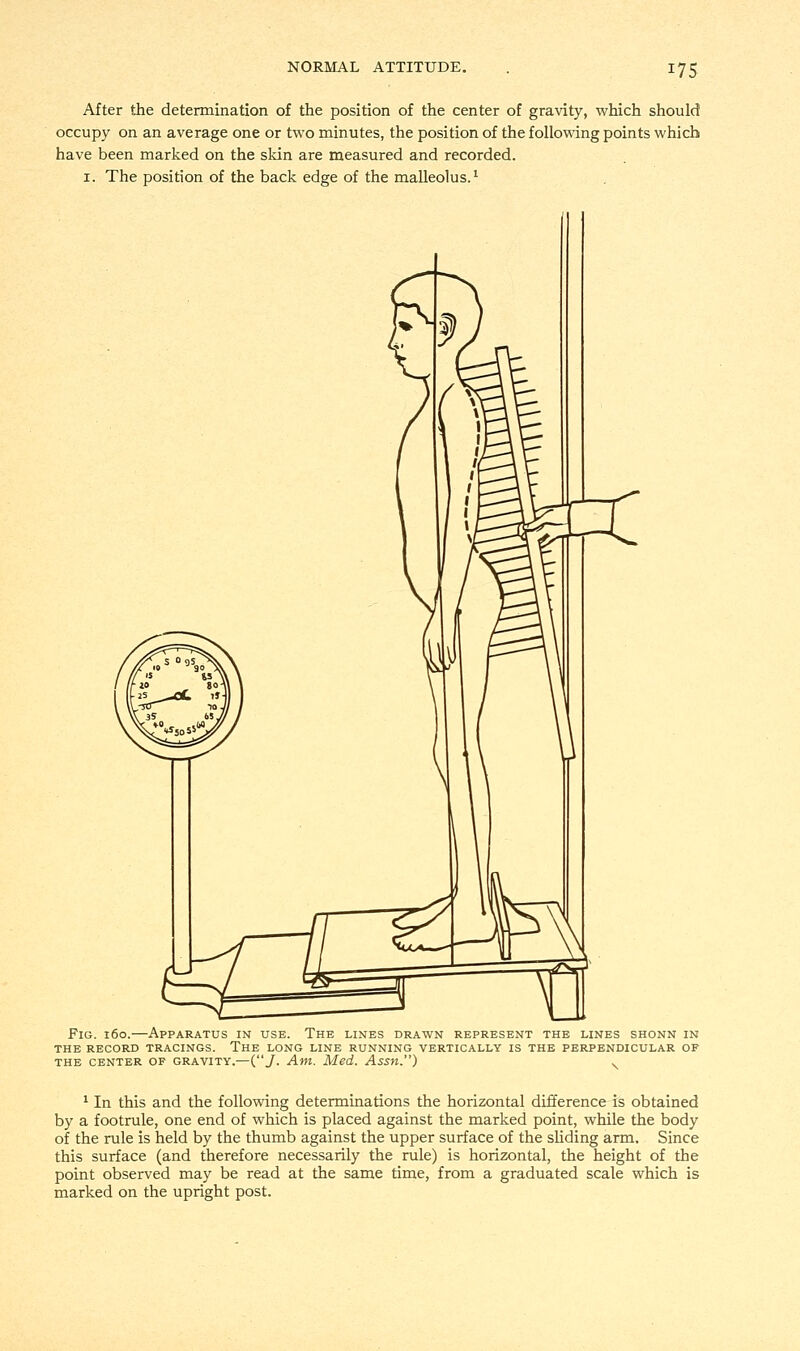 After the determination of the position of the center of gravity, which should occupy on an average one or two minutes, the position of the following points which have been marked on the skin are measured and recorded. 1. The position of the back edge of the malleolus.1 Fig. 160.—Apparatus in use. The lines drawn represent the lines shonn in the record tracings. The long line running vertically is the perpendicular of the center of gravity.—(/• Am. Med. Assn.) v 1 In this and the following determinations the horizontal difference is obtained by a footrule, one end of which is placed against the marked point, while the body of the rule is held by the thumb against the upper surface of the sliding arm. Since this surface (and therefore necessarily the rule) is horizontal, the height of the point observed may be read at the same time, from a graduated scale which is marked on the upright post.