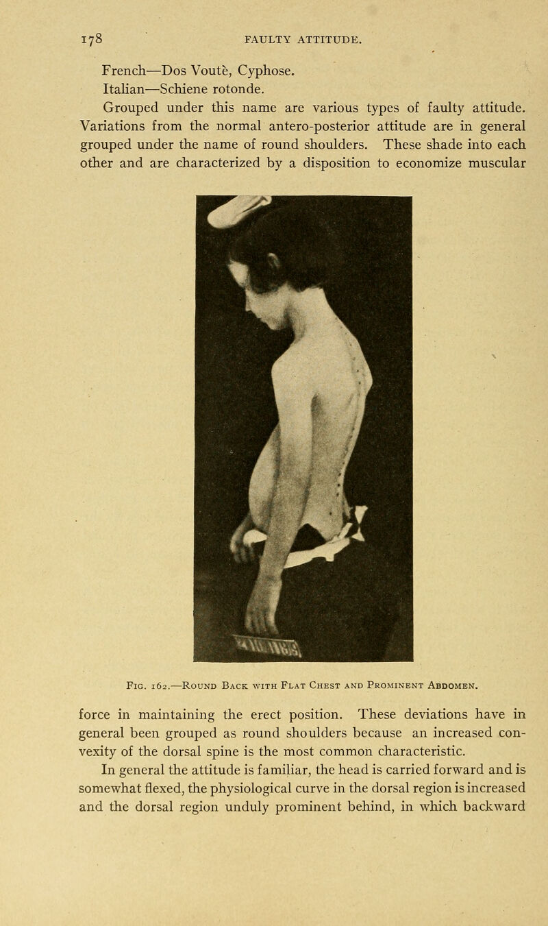 French—Dos Voute, Cyphose. Italian—Schiene rotonde. Grouped under this name are various types of faulty attitude. Variations from the normal antero-posterior attitude are in general grouped under the name of round shoulders. These shade into each other and are characterized by a disposition to economize muscular Fig. 162.—Round Back with Flat Chest and Prominent Abdomen. force in maintaining the erect position. These deviations have in general been grouped as round shoulders because an increased con- vexity of the dorsal spine is the most common characteristic. In general the attitude is familiar, the head is carried forward and is somewhat flexed, the physiological curve in the dorsal region is increased and the dorsal region unduly prominent behind, in which backward