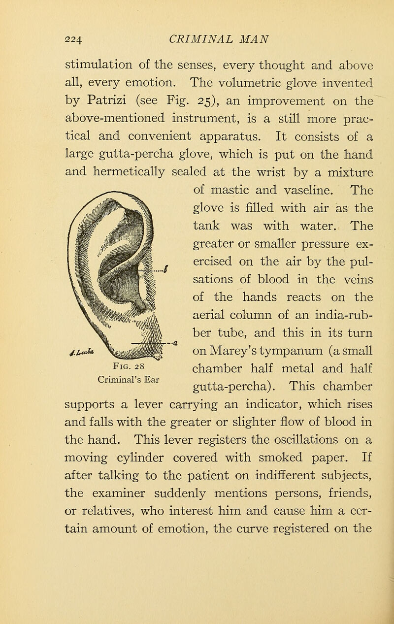 stimulation of the senses, every thought and above all, every emotion. The volumetric glove invented by Patrizi (see Fig. 2^), an improvement on the above-mentioned instrument, is a still more prac- tical and convenient apparatus. It consists of a large gutta-percha glove, which is put on the hand and hermetically sealed at the wrist by a mixture of mastic and vaseline. The glove is filled with air as the tank was with water. The greater or smaller pressure ex- ercised on the air by the pul- sations of blood in the veins of the hands reacts on the aerial column of an india-rub- ber tube, and this in its turn on Marey's tympanum (a small chamber half metal and half gutta-percha). This chamber supports a lever carrying an indicator, which rises and falls with the greater or slighter flow of blood in the hand. This lever registers the oscillations on a moving cylinder covered with smoked paper. If after talking to the patient on indifferent subjects, the examiner suddenly mentions persons, friends, or relatives, who interest him and cause him a cer- tain amount of emotion, the curve registered on the Fig. 28 Criminal's Ear