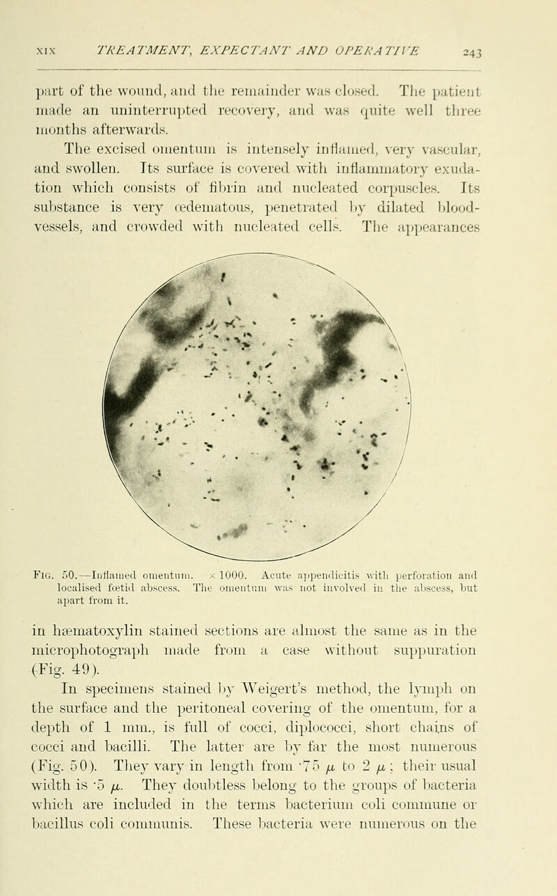 part of the wound, and the remainder was closed. The patienl made an uninterrupted recovery, and was quite well three months afterwards. The excised omentum is intensely inflamed, very vascular, and swollen. Its surface is covered with inflammatory exuda- tion which consists of fibrin and nucleated corpuscles. Its substance is very (edematous, penetrated by dilated blood- vessels, and crowded with nucleated cells. The appearances Fig. 50.—Inflamed omentum, x 1000. Acute appendicitis with perforation and localised foetid abscess. The omentum was not involved in the abscess, but apart from it. in hsernatoxylin stained sections are almost the same as in the microphotograph made from a case without suppuration (Fig. 49). In specimens stained by Weigert's method, the lymph on the surface and the peritoneal covering of the omentum, for a depth of 1 mm., is full of cocci, diplococci, short chains of cocci and bacilli. The latter are by far the most numerous (Fig. 50). They vary in length from -75 /j, to 2 //,; their usual width is '5 /x. They doubtless belong to the groups of bacteria which are included in the terms bacterium coli commune or bacillus coli communis. These bacteria were numerous on the