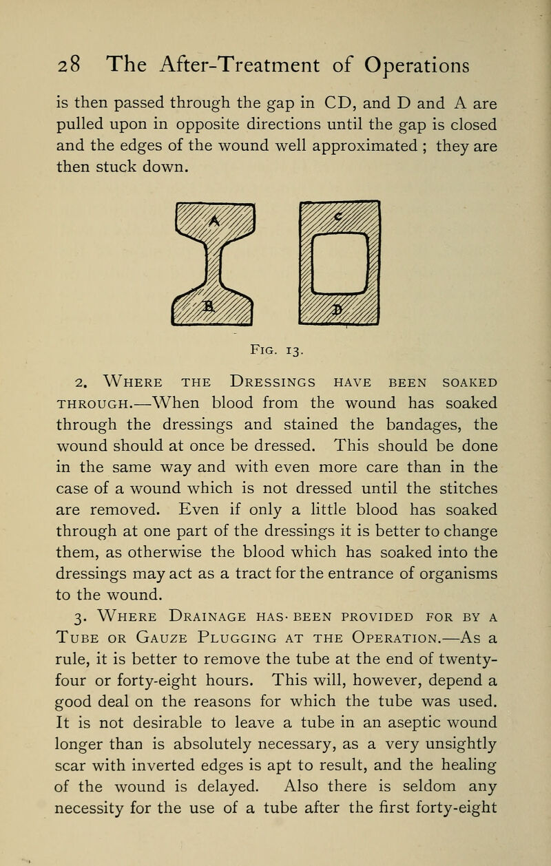 is then passed through the gap in CD, and D and A are pulled upon in opposite directions until the gap is closed and the edges of the wound well approximated ; they are then stuck down. Fig. 13. 2. Where the Dressings have been soaked THROUGH.—When blood from the wound has soaked through the dressings and stained the bandages, the wound should at once be dressed. This should be done in the same way and with even more care than in the case of a wound which is not dressed until the stitches are removed. Even if only a little blood has soaked through at one part of the dressings it is better to change them, as otherwise the blood which has soaked into the dressings may act as a tract for the entrance of organisms to the wound. 3. Where Drainage has- been provided for by a Tube or Gauze Plugging at the Operation.—As a rule, it is better to remove the tube at the end of twenty- four or forty-eight hours. This will, however, depend a good deal on the reasons for which the tube was used. It is not desirable to leave a tube in an aseptic wound longer than is absolutely necessary, as a very unsightly scar with inverted edges is apt to result, and the healing of the wound is delayed. Also there is seldom any necessity for the use of a tube after the first forty-eight
