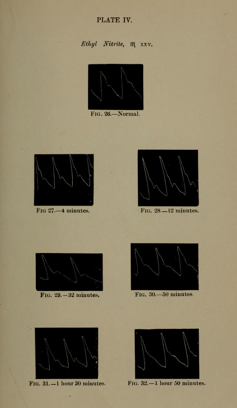 Ethyl Nitrite^ HI xxv. Fig. 2(>.—Normal. Fig 27.-4 minutes. F'lG. 28 12 minutes. Fig. 29.—32 minutes. Fig. 30.—50 minutes.