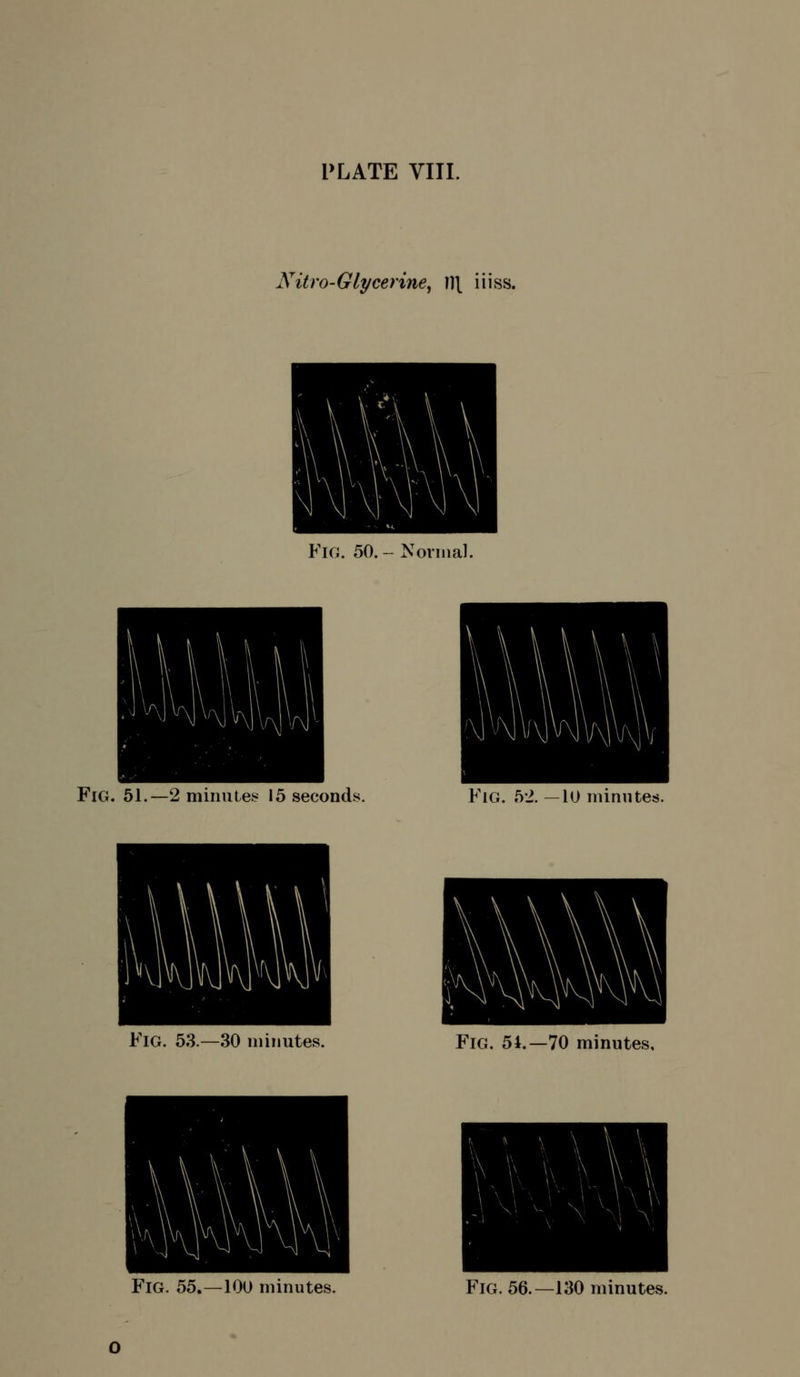 Nitro-Glycerine^ ]]\ iiiss. P'iG. 50. - Normal. Fig. 51.—2 miniiLes 15 seconds. Fig. 5-2. —10 niinntes. Fig. 53.—30 minutes. Fig. 54.—70 minutes.