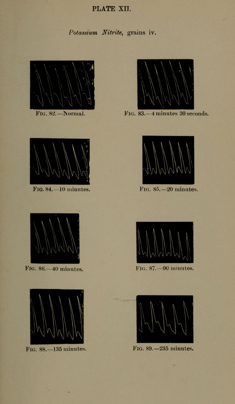 Potassium Nitrite, grains iv. Fig. 82.—Mormal. Fig. 83.—4 minutes 30 seconds. Fig. 84.—10 minutes. Fig. 85.—20 minutes. Fig. 86.—40 minutes. Fig. 87.—90 minutes.