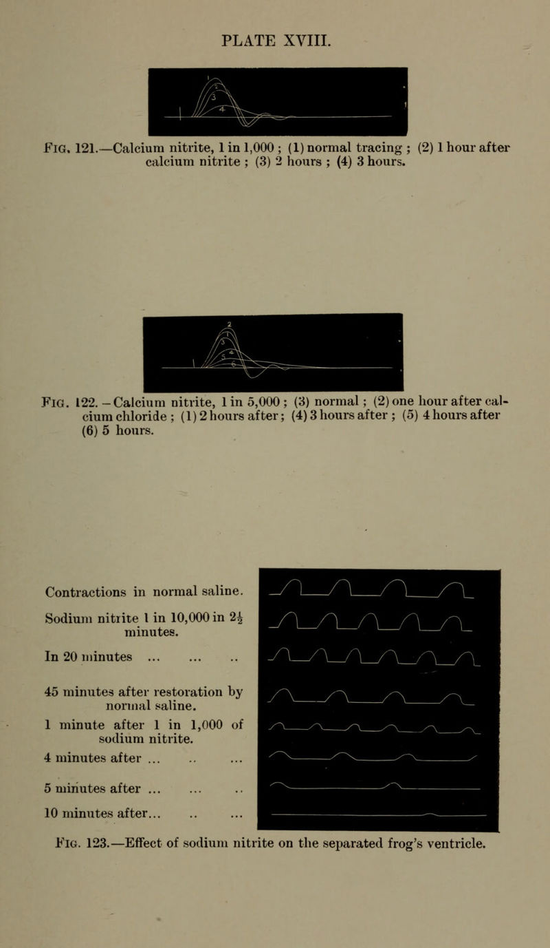 Fig, 121.—Calcium nitrite, 1 in 1,000 ; (1) normal tracing ; (2) 1 hour after calcium nitrite ; (3) 2 hours ; (4) 3 hours. Fig. 122.-Calcium nitrite, 1 in 5,000; (3) normal; (2) one hour after cal- cium chloride ; (1) 2 hours after; (4) 3 hours after ; (5) 4 hours after (6) 5 hours. Contractions in normal saline. Sodium nitrite I in 10,000 in 2^ minutes. In 20 minutes ... 45 minutes after restoration by normal saline. 1 minute after 1 in 1,000 of sodium nitrite. 4 minutes after 5 minutes after ... 10 minutes after Fig. 123.—Effect of sodium nitrite on the separated frog's ventricle.
