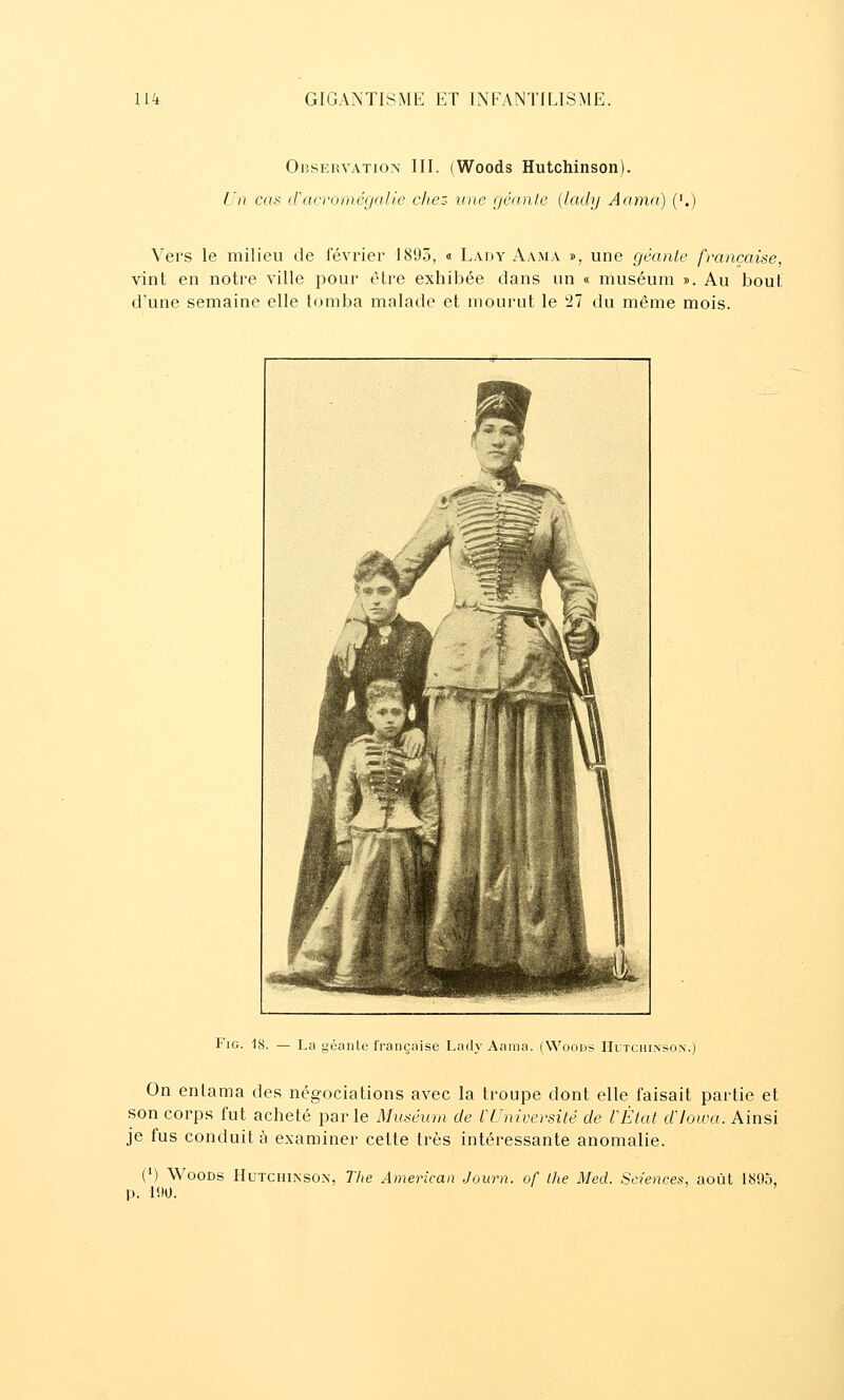 Obskrvation III. (Woods Hutchinson). Un cas d'acroniégalie chez une géante {lady Aarna) ('.) Vers le milieu de février 1895, « Lady Aama », une géante française, vint en notre ville pour être exhibée dans un « muséum ». Au bout d'une semaine elle tomba malade et mourut le 27 du même mois. FiG. 18. — La géante française Lady Aama. (Woods Hutchinson.) On entama des négociations avec la troupe dont elle faisait partie et son corps fut acheté parle Muséum de l'Université de VÈtat d'Jowa. Ainsi je fus conduit à examiner cette très intéressante anomalie. (M Woods Hutchinson, The American Journ. of the Med. Sciences, août 1895, p. 190. '