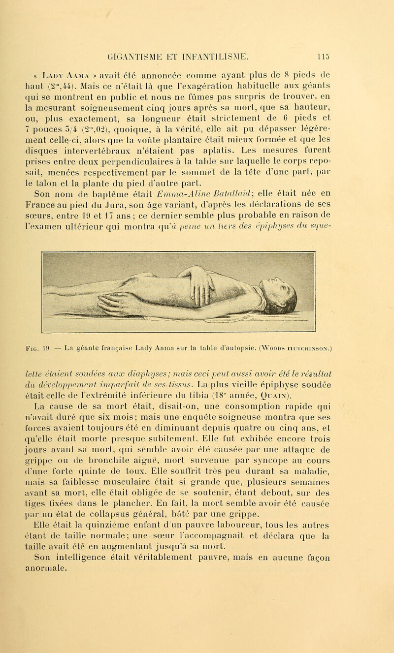 « Lady Aama » avait été annoncée comme ayant plus de 8 pieds de haut (2,44). Mais ce n'était là que l'exagération habituelle aux géants qui se montrent en public et nous ne fûmes pas surpris de trouver, en la mesurant soigneusement cinq jours après sa mort, que sa hauteur, ou, plus exactement, sa longueur était strictement de 6 pieds et 7 pouces 5/4 (2',02), quoique, à la vérité, elle ait pu dépasser légère- ment celle-ci, alors que la voûte plantaire était mieux formée et que les disques intervertébraux n'étaient pas aplatis. Les mesures furent prises entre deux perpendiculaires à la table sur laquelle le corps repo- sait, menées respectivement par le sommet de la tête d'une part, par le talon et la plante du pied d'autre part. Son nom de baptême était Emma-Aline Batallaid; elle était née en France au pied du Jura, son âge variant, d'après les déclarations de ses sœurs, entre 19 et 17 ans ; ce dernier semble plus probable en raison de l'examen ultérieur qui montra qu'à peine un hers des épiphyses du sque- FiG. 19. — La géanle française Lady Aama sur la table d'aulopsie. (Woods hutchinson.) lette étaient soudées aux diaphyses ; mais ceci peut aussi avoir été le résultat du dévelopjpement imparfait de ses tissus. La plus vieille épiphyse soudée était celle de l'extrémité inférieure du tibia (18 année, Quain). La cause de sa mort était, disait-on, une consomption l'apide qui n'avait duré que six mois; mais une enquête soigneuse montra que ses forces avaient toujours été en diminuant depuis quatre ou cinq ans, et qu'elle était morte presque subitement. Elle fut exhibée encore trois jours avant sa mort, qui semble avoir été causée par une attaque de grippe ou de bronchite aiguë, mort survenue par syncope au cours d'une forte c{uinte de toux. Elle souffrit très peu durant sa maladie, mais sa faiblesse musculaire était si grande que, plusieurs semaines avant sa mort, elle était obligée de se soutenir, étant debout, sur des tiges fixées dans le plancher. En fait, la mort semble avoir été causée par un état de collapsus général, hâté par une grippe. Elle était la quinzième enfant d'un pauvre laboureur, tous les autres étant de taille normale; une sœur l'accompagnait et déclara que la taille avait été en augmentant jusqu'à sa mort. Son intelligence était véritablement pauvre, mais en aucune façon anormale.