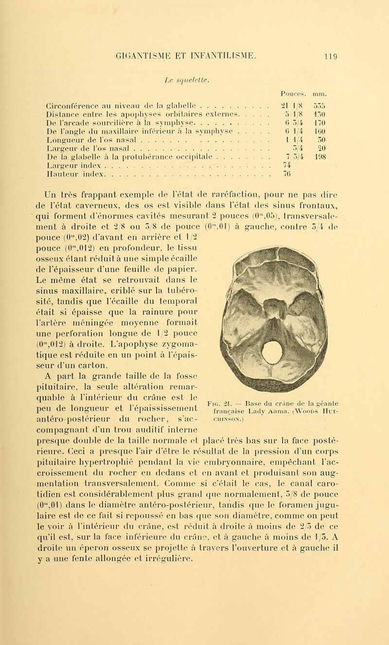 Le squelelle. Circonférence au niveau de la glabelle Distance entre les apophyses orbitaires externes. . . . De l'arcade sourcilière à la symphyse De l'angle du maxillaire inférieur à la symphyse .... Longueur de l'os nasal Largeur de l'os nasal De la glabelle à la protubérance occipitale Largeur index 74 Hauteur index 76 Pouces. mm. 21 1/8 55.'j 5 1/8 150 6 5/4 170 G 1/4 loO 1 1/4 50 .3/4 20 7 5/4 198 Un très frappant exemple de l'état de raréfaction, pour ne pas dire de l'état caverneux, des os est visible dans l'état des sinus frontaux, qui forment d'énormes cavités mesurant 2 pouces (0,05), transversale- ment à droite et 2/8 ou 3/8 de pouce (O^jOl) à gauche, contre 5/4 de pouce (0,02) d'avant en arrière et 1/2 pouce (0',012) en profondeur, le tissu osseux étant réduit à une simple écaille de l'épaisseur d'une feuille de papier. Le même état se retrouvait dans le sinus maxillaire, criblé sur la tubéro- site, tandis que l'écaille du temporal était si épaisse que la rainure pour l'artère méningée moyenne formait une perforation longue de 1/2 pouce (0°',0r2) à droite. L'apophyse zygoma- tique est réduite en un point à l'épais- seur d'un carton. A part la grande taille de la fosse pituitaire, la seule altération remar- quable à l'intérieur du crâne est le peu de longueur et l'épaississement antéro-postérieur du rocher, s'ac- compagnant d'un trou auditif interne presque double de la taille normale et placé très bas sur la face posté- rieure. Ceci a presque l'air d'être le résultat de la pression d'un corps pituitaire hypertrophié pendant la vie embryonnaire, empêchant l'ac- croissement du rocher en dedans et en avant et produisant son aug- mentation transversalement. Comme si c'était le cas, le canal caro- tidien est considérablement plus grand que normalement, 5/8 de pouce (0'°,01) dans le diamètre antéro-postérieur, tandis que le foramen jugu- laire est de ce fait si repoussé en bas que son diamètre, comme on peut le voir à l'intérieur du crâne, est réduit à droite à moins de 2/5 de ce qu'il est, sur la face inférieure du crâne, et à gauche à moins de 1/5. A droite un éperon osseux se projette à travers l'ouverture et à gauche il y a une fente allongée et irrégulière. FiG. 21. — Base du crâne de la géante française Lady Aama. (Woods Hut- CHIiNSON.)