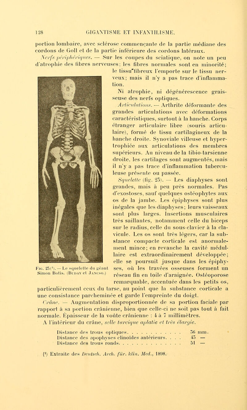 portion lombaire, avec sclérose commençante de la partie médiane des cordons de Goll et de la partie inférieure des cordons latéraux. Nerfs ■périphériques. — Sur les coupes du sciatique, on note un peu d'ati'ophie des fibres nerveuses; les fibres normales sont en minorité; le tissuTibreux l'emporte sur le tissu ner- veux; mais il n'y a pas trace d'inflamma- tion. i^ -'^B^H^H ^^ atrophie, ni dégénérescence grais- seuse des nerfs optiques. Articulations. — Arthrite déformante des grandes articulations avec déformations caractéristiques, surtout à la hanche. Corps étranger articulaire libre (souris articu- laire), formé de tissu cartilagineux de la hanche droite. Synoviale villeuse et hyper- trophiée aux articulations des membres ^^ supérieurs. Au niveau de la tibio-tarsienne %_^,^mi^B droite, les cartilages sont augmentés, mais il n'y a pas trace d'inflammation tubercu- leuse présente ou passée. Squelette (fig. 25). — Les diaphyses sont grandes, mais à peu près normales. Pas d'exostoses, sauf quelques ostéophytes aux os de la jambe. Les épiphyses sont plus inégales que les diaphyses; leurs vaisseaux sont plus larges. Insertions musculaires très saillantes, notamment celle du biceps sur le radius, celle du sous-clavier à la cla- vicule. Les os sont très légers, car la sub- stance compacte corticale est anormale- ment mince; en revanche la cavité médul- [|V ^^ laire est extraordinairement développée; elle se poursuit jusque dans les épiphy- FiG. 23('). —Le squelette du géant ses, oîi les travées osseuses forment un Simon Boiis. (Buday et Jancso.) ^éscau fin en toile d'araignée. Ostéoporose remarquable, accentuée dans les petits os, particulièrement ceux du tarse, au point que la substance corticale a une consistance parcheminée et garde l'empreinte du doigt. Crâne. — Augmentation disproportionnée de sa portion faciale par rapport à sa portion crânienne, bien que celle-ci ne soit pas tout à fait normale. Epaisseur de la voûte crânienne : 4 à 7 millimètres. A l'intérieur du crâne, selle tarcique aplatie et très élargie. Dislance des trous optiques 56 mm. Distance des apophyses cHnoïdes antérieurs. ... 45 — Distance des trous ronds 51 —