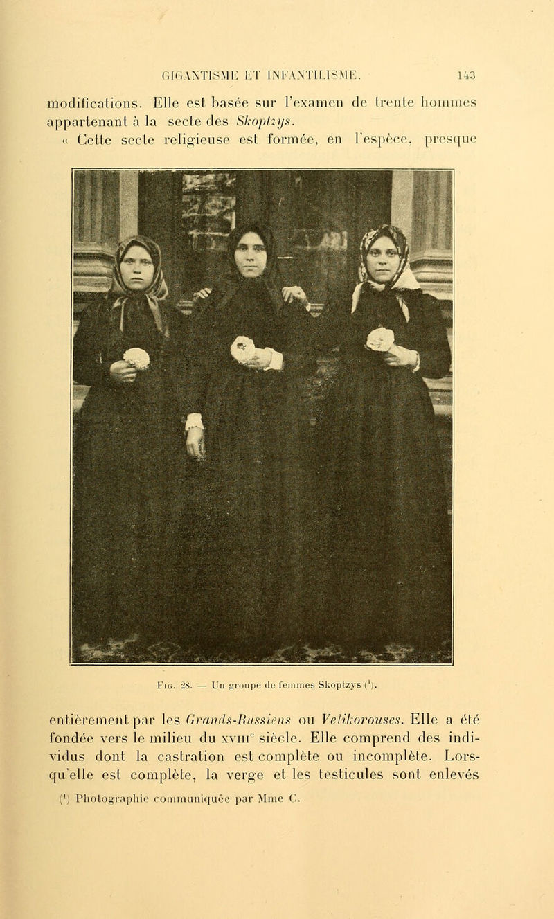 modifications. Elle est basée sur l'examen de trente hommes appartenant à la secte des Skoplzys. « Cette secte religieuse est formée, en Tespèce, presque FiG. 28. — Un groupe de femmes Skoptzys ('). entièrement par les Grands-Rnssiens ou Velikorouses. Elle a été fondée vers le milieu du xvni'' siècle. Elle comprend des indi- vidus dont la castration est complète ou incomplète. Lors- qu'elle est complète, la verge et les testicules sont enlevés