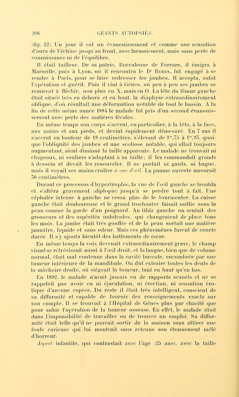 (fig. 22). Un jour il eut un évanouissement et comme une sensation d'aura de Féchine jusqu'au front, avec larmoiement, mais sans perte de connaissance ni de l'équilibre. Il était tailleur. De sa patrie, Boccaleone de Ferrare, il émigra à Marseille, puis à Uyon, où il rencontra le D' Rodin, fut engagé à se rendre à Paris, pour se faire redresser les jambes. Il accepta, subit l'opération et guérit. Puis il vint à Gênes, où peu à peu ses jambes se remirent à fléchir, non plus en X, mais en O. La tête du fémur gauche était située très en dehors et en haut, la diaphyse extraordinairement oblique, d'où résultait une déformation notable de tout le bassin. A la fin de cette même année 1884 le malade fut pris d'un second évanouis- sement avec perte des matières fécales. En même temps son corps s'accrut, en particulier, à la tête, à la face, aux mains et aux pieds, et devint rapidement démesuré. En 7 ans il s'accrut en hauteur de 18 centimètres, s'élevant de I,7o à l',95, quoi- que l'obliquité des jambes et une scoliose notable, qui allait toujours augmentant, aient diminué la taille apparente. Le malade ne trouvait ni chapeaux, ni souliers s'adaptant à sa taille; il les commandait grands à dessein et devait les renouveler. Il ne portait ni gants, ni bague, mais il voyait ses mains croître à vue cVœil. La paume ouverte mesurait 50 centimètres. Durant ce processus d'hypertrophie, la vue de l'œil gauche se troubla et s'altéra gravement (diplopie) jusqu'à se perdre tout à fait. Une céphalée intense à gauche ne cessa plus de le tourmenter. La cuisse gauche était douloureuse et le grand trochanler faisait saillie sous la peau comme la garde d'un poignard. Au tibia gauche on sentait des grosseurs et des aspérités indolentes, qui changeaient de place tous les mois. La jambe était très gonflée et de la peau sortait une matière jaunâtre, liquide et sans odeur. Mais ces phénomènes furent de courte durée. Il s'y ajouta bientôt des battements de cœur. En même temps la voix devenait extraordinairement grave, le champ visuel se rétrécissait aussi à Fœil droit, et la langue, bien que de volume normal, était mal contenue dans la cavité buccale, encombrée par une tumeur intérieure de la mandibule. On dut extraire toutes les dents de la mâchoire droite, où siégeait la tumeur, tant en haut qu'en bas. En 1892, le malade n'avait jamais eu de rapports sexuels et ne se rappelait pas avoir eu ni éjaculation, ni érection, ni sensation ero- tique d'aucune espèce. Du reste il était très intelligent, conscient de sa difformité et capable de fournir des renseignements exacts sur son compte. Il se trouvait à l'Hôpital de Gênes plus par charité que pour subir l'opération de la tumeur osseuse. En effet, le malade était dans l'impossibilité de travailler ou de trouver un emploi. Sa diffor- mité était telle qu'il ne pouvait sortir de la maison sans attirer une foule curieuse qui lui montrait sans retenue son étonnement mêlé d'horreur. Aspect infantile, qui contrastait avec l'âge (25 ans), avec la taille