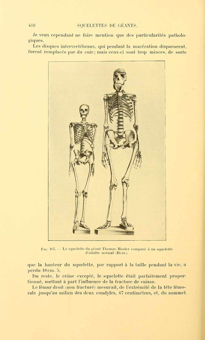 Je veux cependant ne faire mention que des particularités patholo- giques. Les disques intervertébraux, qui pendant la macération disparurent, furent remplacés par du cuir; mais ceux-ci sont trop minces, de sorte FiG. 105. — Le squeleLle du géant Thomas Ilasler comparé à un squclelle d'aciulle normal (Buhl). que la hauteur du squelette, par rapport à la taille pendant la vie, a perdu 10cm. 5. Du reste, le crâne excepté, le squelette était parfaitement propor- tionné, mettant à part l'influence de la fracture de cuisse. Le fémur droit (non fracturé) mesurait, de l'extrémité de la tête fémo- rale jusqu'au milieu des deux condyles, 67 centimètres, et, du sommet