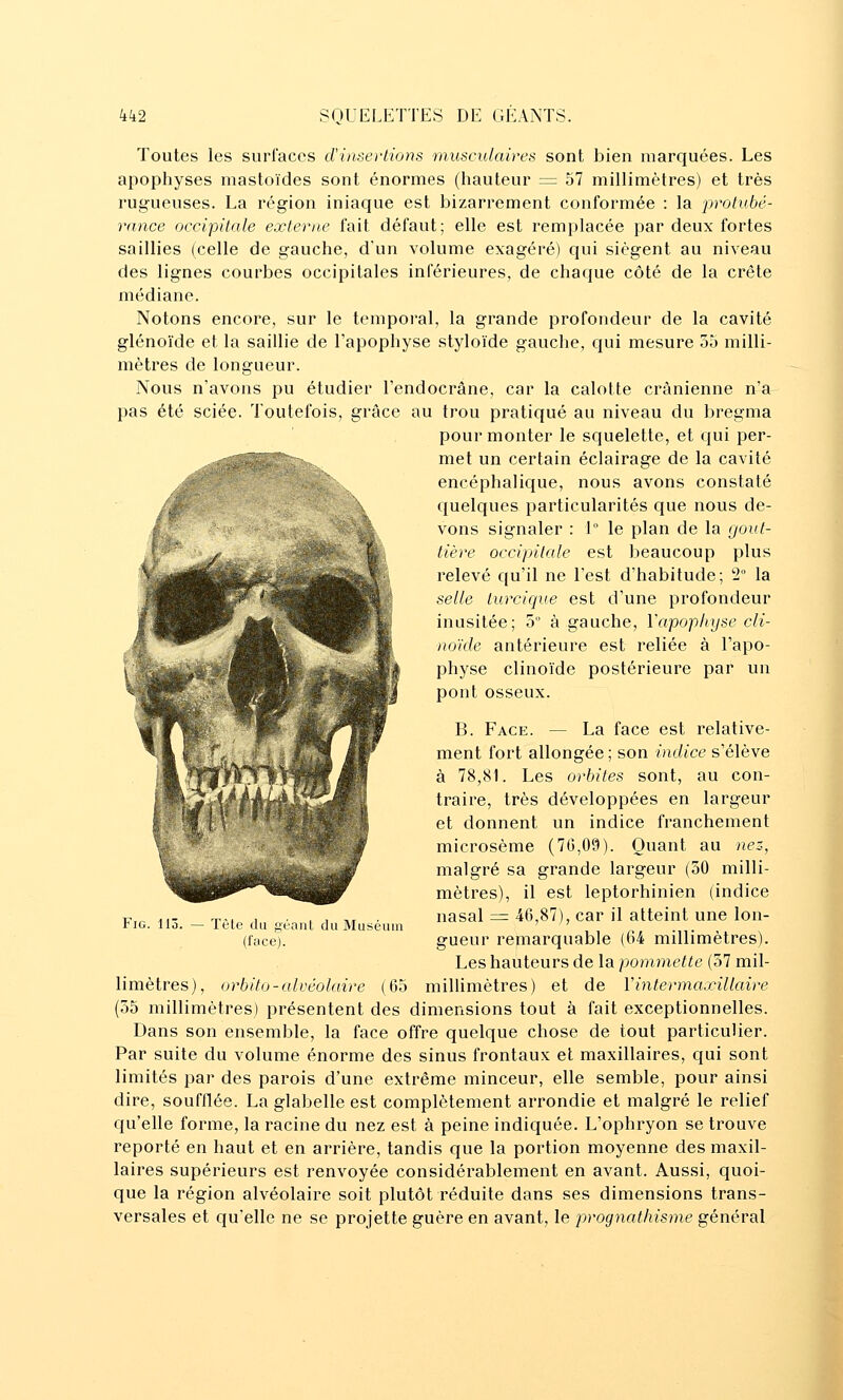 Toutes les surfaces d'insertions musculaires sont bien marquées. Les apophyses mastoïdes sont énormes (hauteur = 57 millimètres) et très rugueuses. La région iniaque est bizarrement conformée : la protubé- rance occipitale exterit.e fait défaut; elle est remplacée par deux fortes saillies (celle de gauche, d'un volume exagéré) qui siègent au niveau des lignes courbes occipitales inférieures, de chaque côté de la crête médiane. Notons encore, sur le tempoi'al, la grande profondeur de la cavité glénoïde et la saillie de l'apophyse styloïde gauche, qui mesure 55 milli- mètres de longueur. Nous n'avons pu étudier l'endocrâne, car la calotte crânienne n'a pas été sciée. Toutefois, grâce au trou pratiqué au niveau du bregma pour monter le squelette, et qui per- met un certain éclairage de la cavité encéphalique, nous avons constaté quelques particularités que nous de- vons signaler : 1° le plan de la gout- tière occipitale est beaucoup plus relevé qu'il ne l'est d'habitude; 2° la selle turcique est d'une profondeur inusitée; 5° à gauche, l'apophyse cii- noïcle antérieure est reliée à l'apo- physe clinoïde postérieure par un pont osseux. B. Face. — La face est relative- ment fort allongée; son indice s'élève à 78,81. Les orbites sont, au con- traire, très développées en largeur et donnent un indice franchement microsème (70,09). Quant au nez, malgré sa grande largeur (50 milli- mètres), il est leptorhinien (indice nasal = 46,87), car il atteint une lon- gueur remarquable (64 millimètres). Les hauteurs de la pommette (57 mil- millimètres) et de Vintermaxillaire (55 millimètres) présentent des dimensions tout à fait exceptionnelles. Dans son ensemble, la face offre quelque chose de tout particulier. Par suite du volume énorme des sinus frontaux et maxillaires, qui sont limités par des parois d'une extrême minceur, elle semble, pour ainsi dire, soufflée. La glabelle est complètement arrondie et malgré le relief qu'elle forme, la racine du nez est à peine indiquée. L'ophryon se trouve reporté en haut et en arrière, tandis que la portion moyenne des maxil- laires supérieurs est renvoyée considérablement en avant. Aussi, quoi- que la région alvéolaire soit plutôt réduite dans ses dimensions trans- versales et qu'elle ne se projette guère en avant, le prognathisme général FiG. 113. — Tôle du géaiiL du Muséum (face). limètres), orbito - alvéolaire (65