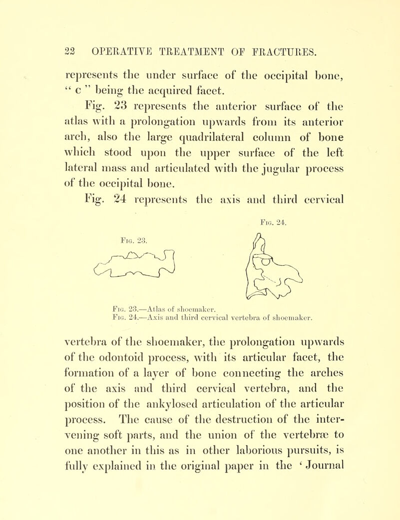 represents the under surface of the occipital bone,  c  being the acquired facet. Fig. 23 represents the anterior surface of the atlas with a prolongation upwards from its anterior arch, also the large quadrilateral column of bone which stood upon the upper surface of the left lateral mass and articulated with the jugular process of the occipital bone. Fig. 24 represents the axis and third cervical Fig. 24. Fig. 23. Fig. 23.—Atlas of shoemaker. Fig. 24.—Axis and third cervical vertebra of slioemaker. vertebra of the shoemaker, the prolongation upwards of the odontoid process, with its articular facet, the formation of a layer of bone connecting the arches of the axis and third cervical vertebra, and the position of the ankylosed articulation of the articular process. The cause of the destruction of the inter- vening soft parts, and the union of the vertebrae to one another in this as in other laborious pursuits, is fully explained in the original paper in the ' Journal