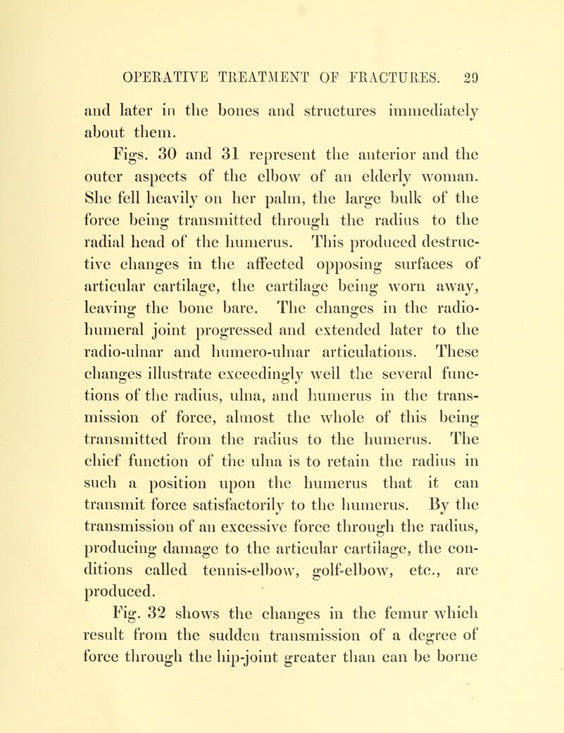 and later in the bones and structures immediately about them. Figs. 30 and 31 represent the anterior and the outer aspects of the elbow of an elderly woman. She fell heavily on her palm, the large bulk of the force being transmitted through the radius to the radial head of the humerus. This produced destruc- tive changes in the affected opposing surfaces of articular cartilage, the cartilage being worn away, leaving the bone bare. The changes in the radio- humeral joint progressed and extended later to the radio-ulnar and humero-ulnar articulations. These changes illustrate exceedingly well the several func- tions of the radius, ulna, and humerus in the trans- mission of force, almost the whole of this being transmitted from the radius to the humerus. The chief function of the ulna is to retain the radius in such a position upon the humerus that it can transmit force satisfactorily to the humerus. By the transmission of an excessive force through the radius, producing damage to the articular cartilage, the con- ditions called tennis-elbow, golf-elbow, etc., are produced. Fig. 32 shows the changes in the femur which result from the sudden transmission of a degree of force through the hip-joint greater than can be borne