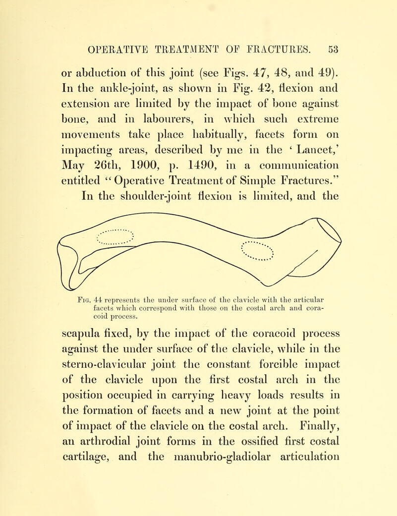 or abduction of this joint (see Figs. 47, 48, and 49). In the ankle-joint, as shown in Fig. 42, flexion and extension are limited by the impact of bone against bone, and in labourers, in which such extreme movements take place habitually, facets form on impacting areas, described by me in the ' Lancet,' May 26th, 1900, p. 1490, in a communication entitled Operative Treatment of Simple Fractures. In the shoulder-joint flexion is limited, and the Fig. 44 represents the under surface of the clavicle with the articular facets which correspond with those on the costal arch and cora- coid process. scapula fixed, by the impact of the coracoid process against the under surface of the clavicle, while in the sterno-clavicular joint the constant forcible impact of the clavicle upon the first costal arch in the position occupied in carrying heavy loads results in the formation of facets and a new joint at the point of impact of the clavicle on the costal arch. Finally, an arthrodial joint forms in the ossified first costal cartilage, and the manubrio-gladiolar articulation