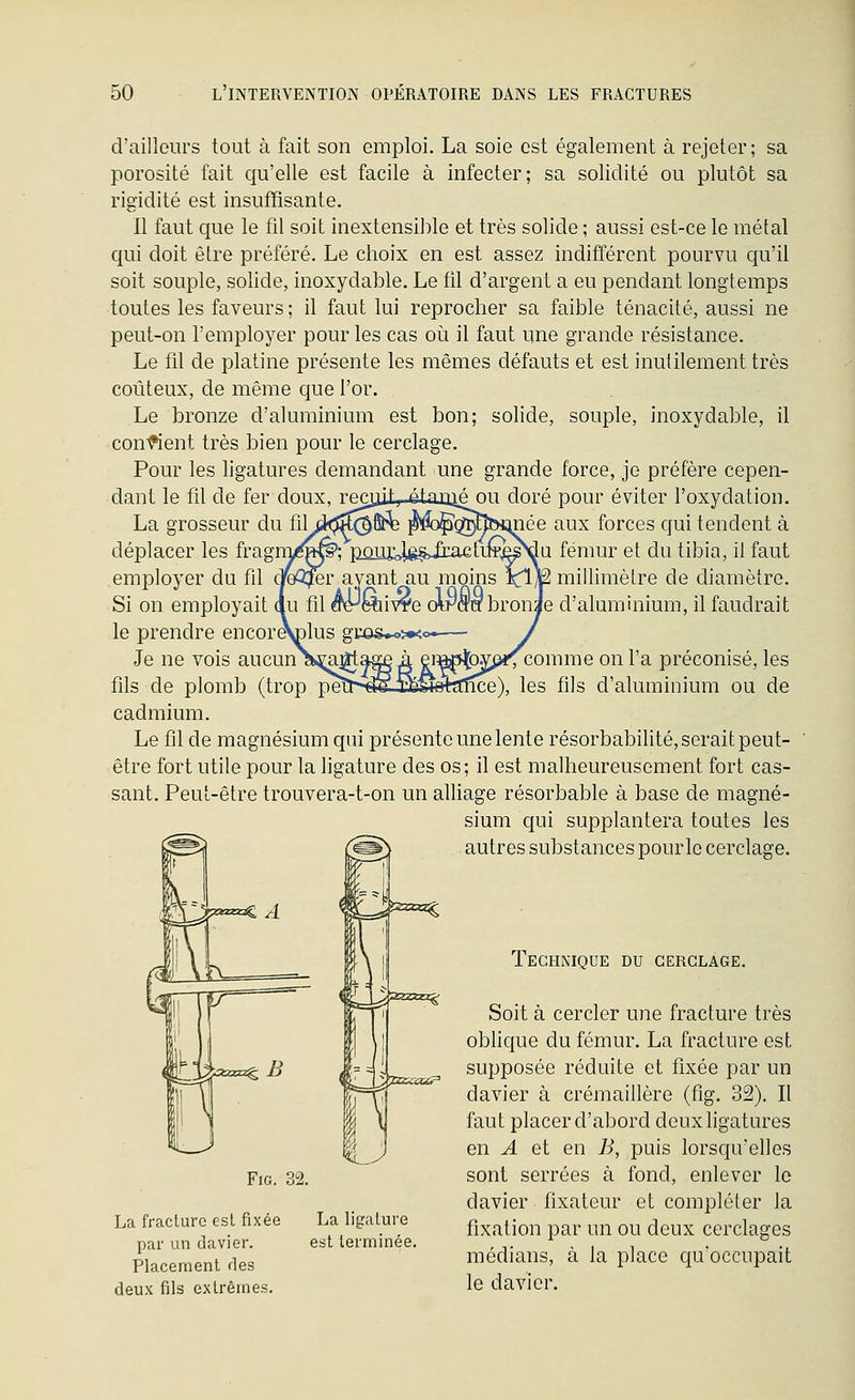 d'ailleurs tout à fait son emploi. La soie est également à rejeter; sa porosité fait qu'elle est facile à infecter; sa solidité ou plutôt sa rigidité est insuffisante. 11 faut que le fil soit inextensible et très solide ; aussi est-ce le métal qui doit être préféré. Le choix en est assez indifférent pourvu qu'il soit souple, solide, inoxydable. Le fil d'argent a eu pendant longtemps toutes les faveurs ; il faut lui reprocher sa faible ténacité, aussi ne peut-on l'employer pour les cas oii il faut une grande résistance. Le fil de platine présente les mêmes défauts et est inutilement très coûteux, de même que l'or. Le bronze d'aluminium est bon; solide, souple, inoxydable, il coii'fient très bien pour le cerclage. Pour les ligatures demandant une grande force, je préfère cepen- dant le fil de fer doux, recuit ^ étai^éou doré pour éviter l'oxydation. La grosseur du fil d^^S^^^ ^éd^^^p^umée aux forces qui tendent à déplacer les fragni^M§>; pûll£4g§>iI:actLfe^^da fémur et du tibia, il faut employer du fil cp3jer ayant au moins xiU millimètre de diamètre. Si on employait du fil èèr^mivre olmabronae d'aluminium, il faudrait le prendre encor^lus gco&^ï^o-— / Je ne vois aucun\^]|tagÊ à em^ovp«^comme on l'a préconisé, les fils de plomb (trop pèît-^SJËÉ^e+aîïce), les fils d'aluminium ou de cadmium. Le fil de magnésium qui présente une lente résorbabilité, serait peut- être fort utile pour la ligature des os; il est malheureusement fort cas- sant. Peut-être trouvera-t-on un aUiage résorbable à base de magné- sium qui supplantera toutes les c^^^ /^^ autres substances pour le cerclage. Technique du cerclage. La fracture est fixée par un clavier. Placement ries deux fils extrêmes. La ligature est terminée. Soit à cercler une fracture très oblique du fémur. La fracture est supposée réduite et fixée par un davier à crémaillère (fig. 32). Il faut placer d'abord deux ligatures en A et en B, puis lorsqu'elles sont serrées à fond, enlever le davier fixateur et compléter la fixation par un ou deux cerclages médians, à la place qu'occupait le davier.