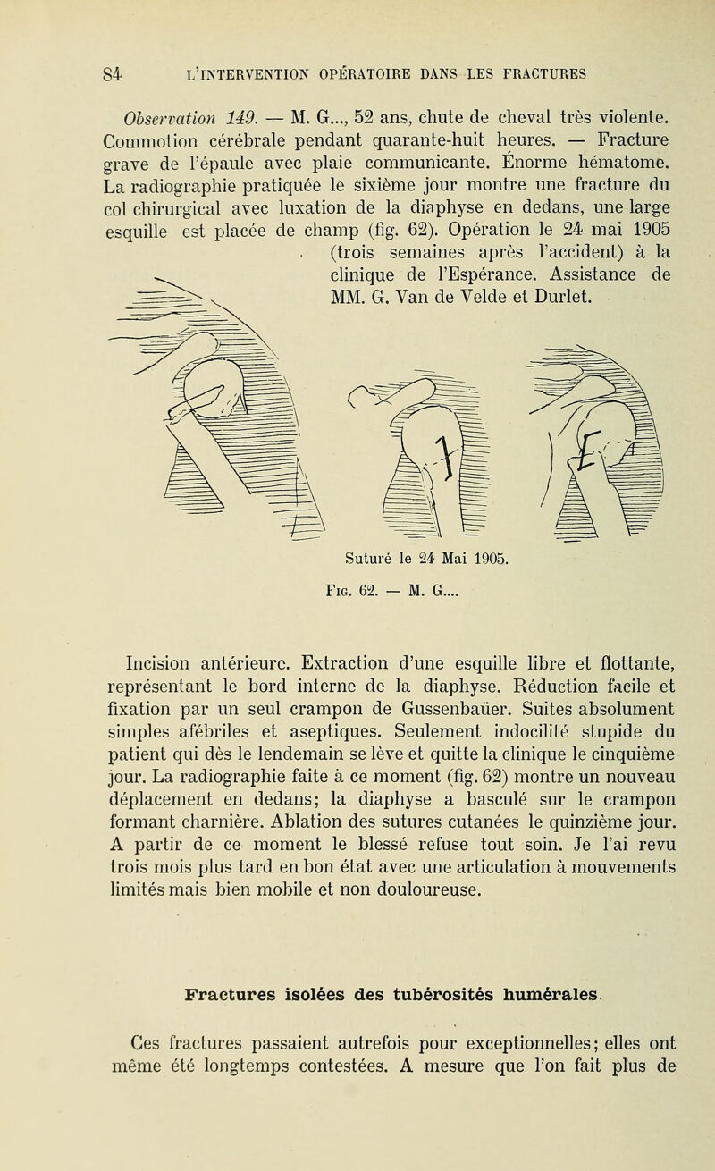 Observation 149. — M. G..., 52 ans, chute de cheval très violente. Commotion cérébrale pendant quarante-huit heures. — Fracture grave de l'épaule avec plaie communicante. Énorme hématome. La radiographie pratiquée le sixième jour montre une fracture du col chirurgical avec luxation de la diaphyse en dedans, une large esquille est placée de champ (flg. 62). Opération le 24 mai 1905 (trois semaines après l'accident) à la chnique de l'Espérance. Assistance de MM. G. Van de Velde et Durlet. Suturé le 24 Mai 1905. FiG. 62. — M. G.... Incision antérieure. Extraction d'une esquille libre et flottante, représentant le bord interne de la diaphyse. Réduction facile et fixation par un seul crampon de Gussenbaûer. Suites absolument simples afébriles et aseptiques. Seulement indocilité stupide du patient qui dès le lendemain se lève et quitte la clinique le cinquième jour. La radiographie faite à ce moment (flg. 62) montre un nouveau déplacement en dedans; la diaphyse a basculé sur le crampon formant charnière. Ablation des sutures cutanées le quinzième jour. A partir de ce moment le blessé refuse tout soin. Je l'ai revu trois mois plus tard en bon état avec une articulation à mouvements limités mais bien mobile et non douloureuse. Fractures isolées des tubérosités humérales. Ces fractures passaient autrefois pour exceptionnelles; elles ont même été longtemps contestées. A mesure que l'on fait plus de