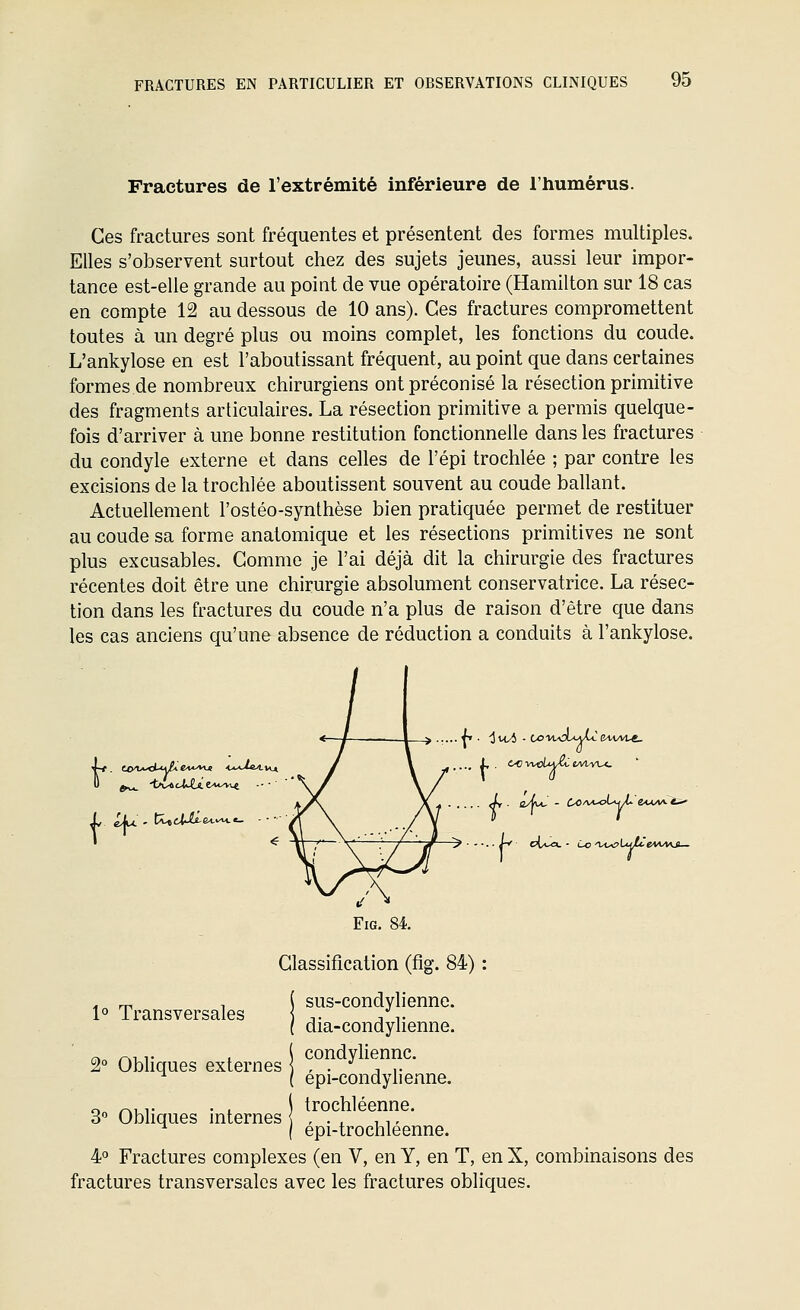 Fractures de l'extrémité inférieure de l'humérus. Ces fractures sont fréquentes et présentent des formes multiples. Elles s'observent surtout chez des sujets jeunes, aussi leur impor- tance est-elle grande au point de vue opératoire (Hamilton sur 18 cas en compte 12 au dessous de 10 ans). Ces fractures compromettent toutes à un degré plus ou moins complet, les fonctions du coude. L'ankylose en est l'aboutissant fréquent, au point que dans certaines formes de nombreux chirurgiens ont préconisé la résection primitive des fragments articulaires. La résection primitive a permis quelque- fois d'arriver à une bonne restitution fonctionnelle dans les fractures du condyle externe et dans celles de l'épi trochlée ; par contre les excisions de la trochlée aboutissent souvent au coude ballant. Actuellement l'ostéo-synthèse bien pratiquée permet de restituer au coude sa forme anatomique et les résections primitives ne sont plus excusables. Gomme je l'ai déjà dit la chirurgie des fractures récentes doit être une chirurgie absolument conservatrice. La résec- tion dans les fractures du coude n'a plus de raison d'être que dans les cas anciens qu'une absence de réduction a conduits à l'ankylose. .... U- t-0vwtfiM^eA^v^.^ FiG. 84. Classification (fig. 84) 1° Transversales 2° Obhques externes 3 Obliques internes sus-condylienne. dia-condylienne. condyliennc. épi-condylienne. trochléenne. épi-trochléenne. 4 Fractures complexes (en V, en Y, en T, en X, combinaisons des fractures transversales avec les fractures obliques.