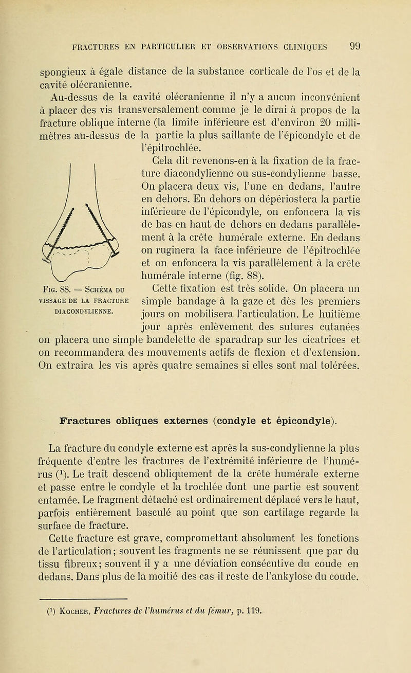 spongieux à égale distance de la substance corticale de l'os et de la cavité olécranienne. Au-dessus de la cavité olécranienne il n'y a aucun inconvénient à placer des vis transversalement comme je le dirai à propos de la fracture oblique interne (la limite inférieure est d'environ 20 milli- mètres au-dessus de la partie la plus saillante de l'épicondyle et de l'épitrochlée. Gela dit revenons-en à la fixation de la frac- ture diacondylienne ou sus-condylienne basse. On placera deux vis, l'une en dedans, l'autre en dehors. En dehors on dépériostera la partie inférieure de l'épicondyle, on enfoncera la vis de bas en haut de dehors en dedans parallèle- ment à la crête humérale externe. En dedans on ruginera la face inférieure de l'épitrochlée et on enfoncera la vis parallèlement à la crête humérale interne (fig. 88). FiG. 88. — Schéma du Cette fixation est très solide. On placera un VISSAGE DE LA FRACTURE siuiplo baudage à la gaze et dès les premiers DIACONDYLIENNE. jours on moblUsera l'articulation. Le huitième jour après enlèvement des sutures cutanées on placera une simple bandelette de sparadrap sur les cicatrices et on recommandera des mouvements actifs de flexion et d'extension. On extraira les vis après quatre semaines si elles sont mal tolérées. Fractures obliques externes (condyle et épieondyle). La fracture du condyle externe est après la sus-condylienne la plus fréquente d'entre les fractures de l'extrémité inférieure de l'humé- rus (^). Le trait descend obhquement de la crête humérale externe et passe entre le condyle et la trochlée dont une partie est souvent entamée. Le fragment détaché est ordinairement déplacé vers le haut, parfois entièrement basculé au point que son cartilage regarde la surface de fracture. Cette fracture est grave, compromettant absolument les fonctions de l'articulation ; souvent les fragments ne se réunissent que par du tissu fibreux; souvent il y a une déviation consécutive du coude en dedans. Dans plus de la moitié des cas il reste de l'ankylose du coude. (') KocHER, Fractures de l'humérus et du fémur, p. 119.