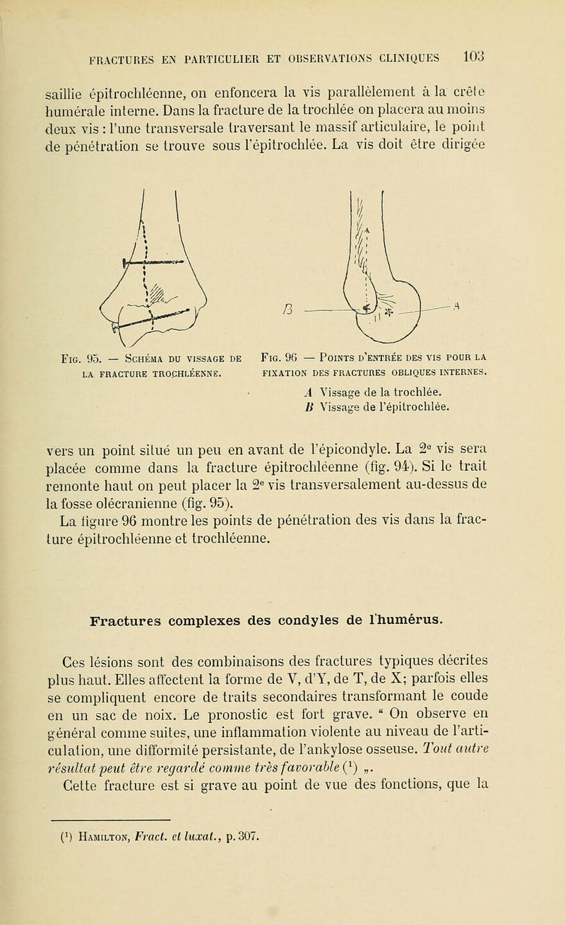 saillie épitrochlécnne, on enfoncera la vis parallèlement à la crête humérale interne. Dans la fracture de la trochlée on placera au moins deux vis : l'une transversale traversant le massif articulaire, le point de pénétration se trouve sous l'épitrochlée. La vis doit être dirigée FiG. 95. — Schéma du vissage de LA FRACTURE TROCHLÉENNE. /3 FiG. 96 — Points d'entrée des vis pour la FIXATION DES FRACTURES OBLIQUES INTERNES. A Vissage de la trochlée. B Vissage de l'épitrochlée. vers un point situé un peu en avant de l'épicondyle. La 2^ vis sera placée comme dans la fracture épitrochléenne (%. 94). Si le trait remonte haut on peut placer la 2« vis transversalement au-dessus de la fosse olécranienne (fig. 95). La iigin-e 96 montre les points de pénétration des vis dans la frac- ture épitrochléenne et trochléenne. Fractures complexes des condyles de l'humérus. Ces lésions sont des combinaisons des fractures typiques décrites plus haut. Elles affectent la forme de V, d'Y, de T, de X; parfois elles se complic[uent encore de traits secondaires transformant le coude en un sac de noix. Le pronostic est fort grave.  On observe en général comme suites, une inflammation violente au niveau de l'arti- culation, une difformité persistante, de l'ankylose osseuse. Tout autre résultat peut être regardé comme très favorable {^) „. Cette fracture est si grave au point de vue des fonctions, que la (') Hamilton, Fract. et luxât., p. 307.