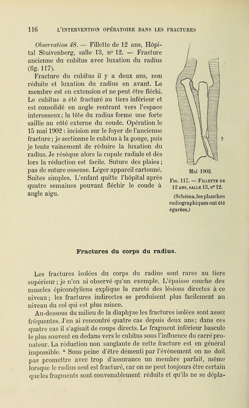 Observation 48. — Fillette de 12 ans, Hôpi- tal Stuivenberg, salle 13, n» 12. — Fracture ancienne du cubitus avec luxation du radius (flg. 117). Fracture du cubitus il y a deux ans, non réduite et luxation du radius en avant. Le membre est en extension et ne peut être fléchi. Le cubitus a été fracturé au tiers inférieur et est consolidé en angle rentrant vers l'espace interosseux; la tête du radius forme une forte saillie au côté externe du coude. Opération le 15 mai 1902 : incision sur le foyer de l'ancienne fracture ; je sectionne le cubitus à la gouge, puis je tente vainement de réduire la luxation du radius. Je résèque alors la cupule radiale et dès lors la réduction est facile. Suture des plaies ; pas de suture osseuse. Léger appareil cartonné. Suites simples. L'enfant quitte l'hôpital après quatre semaines pouvant fléchir le coude à angle aigu. Mai 1902. Fia. 117. — Fillette de 12 ANS, SALLE 13, N» 12. (Schéma,les planches radiographiques ont été égarées.) Fractures du corps du radius. Les fractures isolées du corps du radius sont rares au tiers supérieur ; je n'en ai observé qu'un exemple. L'épaisse couche des muscles épicondyliens explique la rareté des lésions directes à ce niveau; les fractures indirectes se produisent plus facilement au niveau du col qui est plus mince. Au-dessous du milieu de la diaphyse les fractures isolées sont assez fréquentes. J'en ai rencontré quatre cas depuis deux ans ; dans ces quatre cas il s'agisait de coups directs. Le fragment inférieur bascule le plus souvent en dedans vers le cubitus sous l'influence du carré pro- nateur. La réduction non sanglante de cette fracture est on général impossible.  Sous peine d'être démenti par l'événement on ne doit pas promettre avec trop d'assurance un membre parfait, même lorsque le radius seul est fracturé, car on ne peut toujours être certain que les fragments sont convenablement réduits et qu'ils ne se dépla-