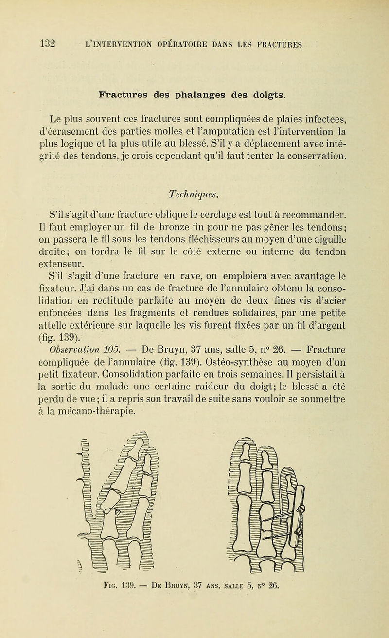 Fractures des phalanges des doigts. Le plus souvent ces fractures sont compliquées de plaies infectées, d'écrasement des parties molles et l'amputation est l'intervention la plus logique et la plus utile au blessé. S'il y a déplacement avec inté- grité des tendons, je crois cependant qu'il faut tenter la conservation. Techniques. S'il s'agit d'une fracture oblique le cerclage est tout à recommander. Il faut employer un fil de bronze fm pour ne pas gêner les tendons ; on passera le fil sous les tendons fléchisseurs au moyen d'une aiguille droite; on tordra le fil sur le côté externe ou interne du tendon extenseur. S'il s'agit d'une fracture en rave, on emploiera avec avantage le fixateur. J'ai dans un cas de fracture de l'annulaire obtenu la conso- lidation en rectitude parfaite au moyen de deux fines vis d'acier enfoncées dans les fragments et rendues solidaires, par une petite attelle extérieure sur laquelle les vis furent fixées par un fil d'argent (fig. 139). Observation 105. — De Bruyn, 37 ans, salle 5, n° 26. — Fracture compliquée de l'annulaire (fig. 139). Ostéo-synthèse au moyen d'un petit fixateur. Consolidation parfaite en trois semaines. Il persistait à la sortie du malade une certaine raideur du doigt; le blessé a été perdu de vue ; il a repris son travail de suite sans vouloir se soumettre à la mécano-thérapie. Fie. 139, — De Bruyn, 37 ans, salle 5, n°